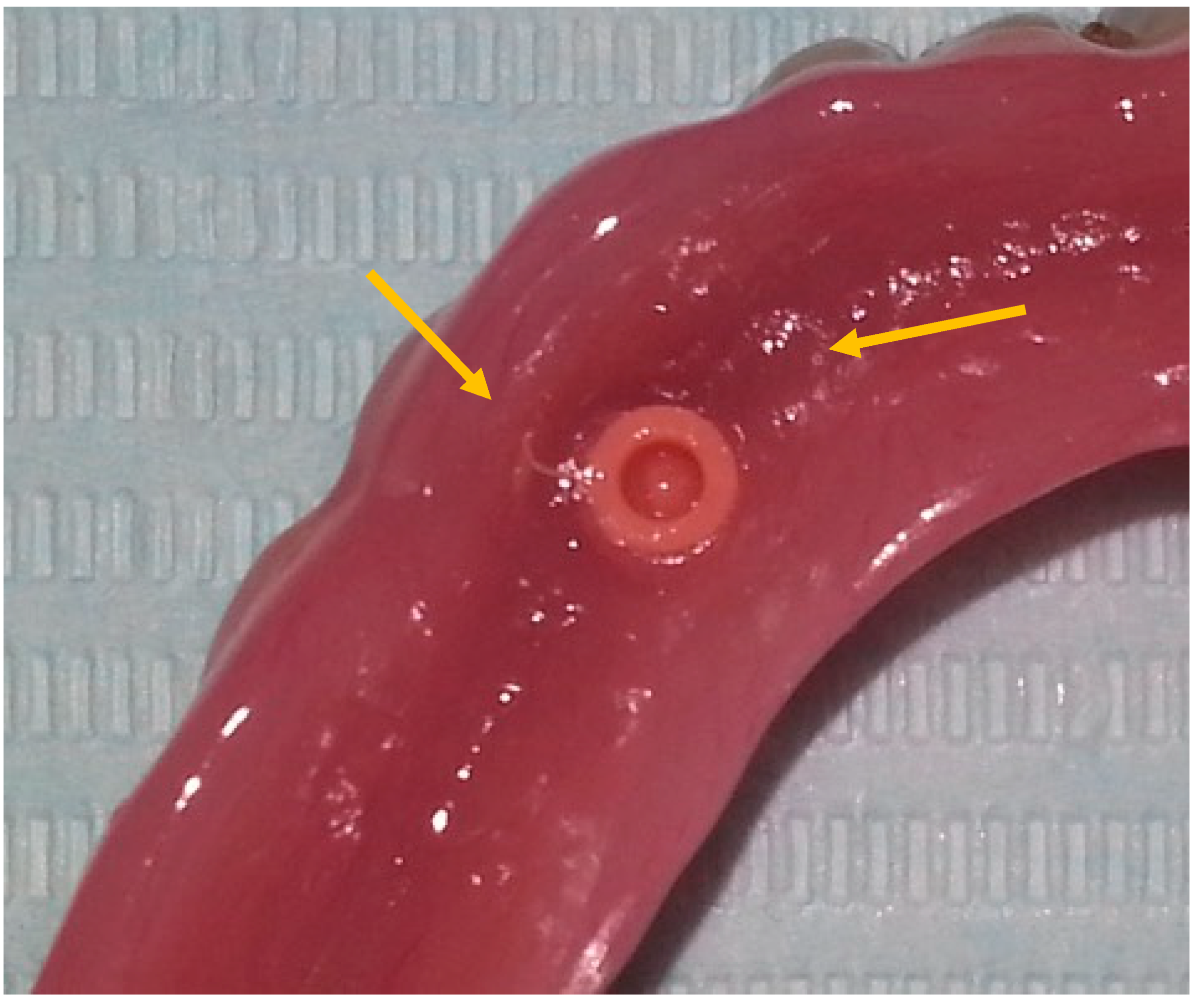 Prosthesis 02 00016 g012 Prosthesis 02 00016 g012