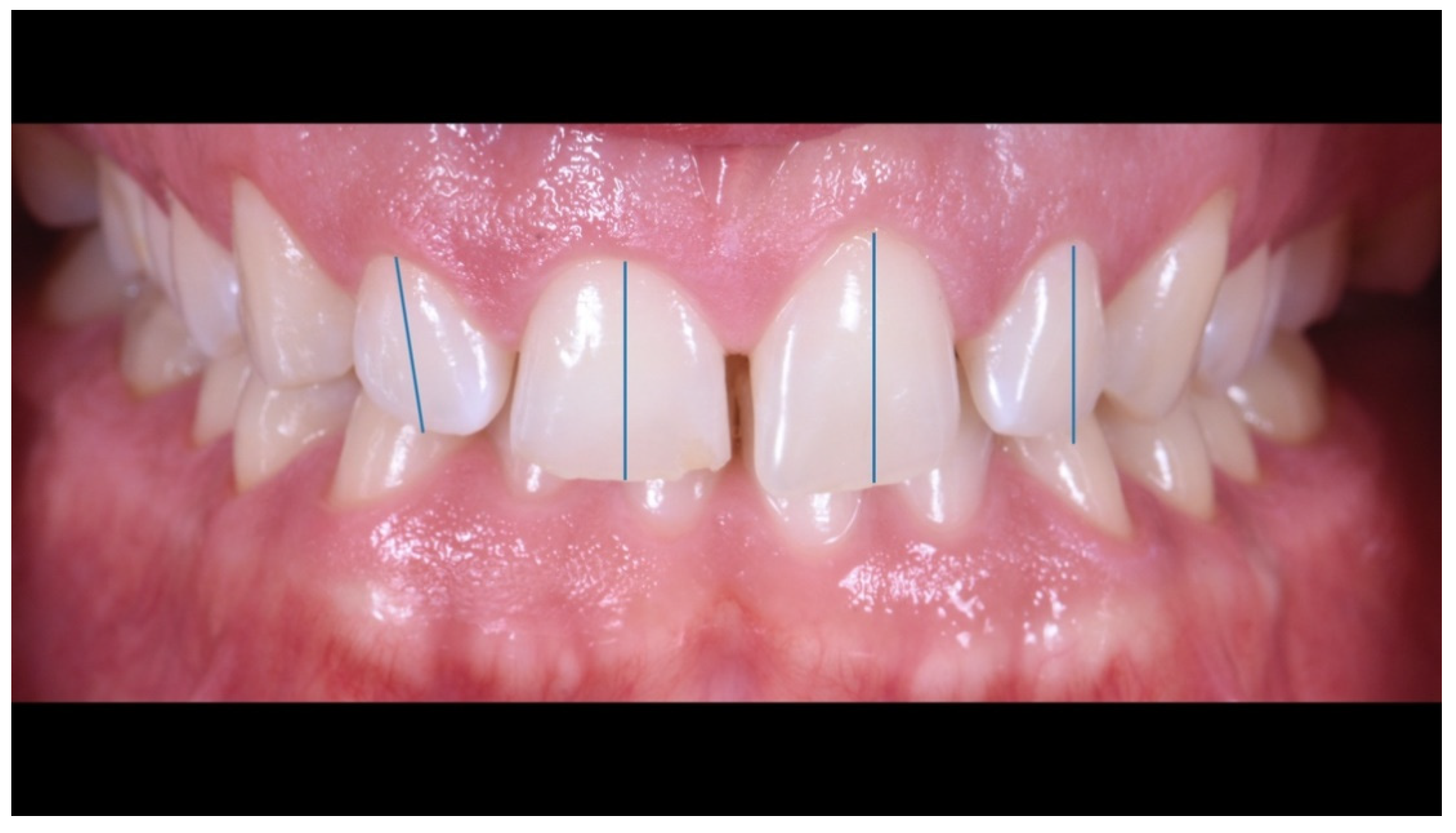 Prosthesis 02 00017 g003 Prosthesis 02 00017 g003