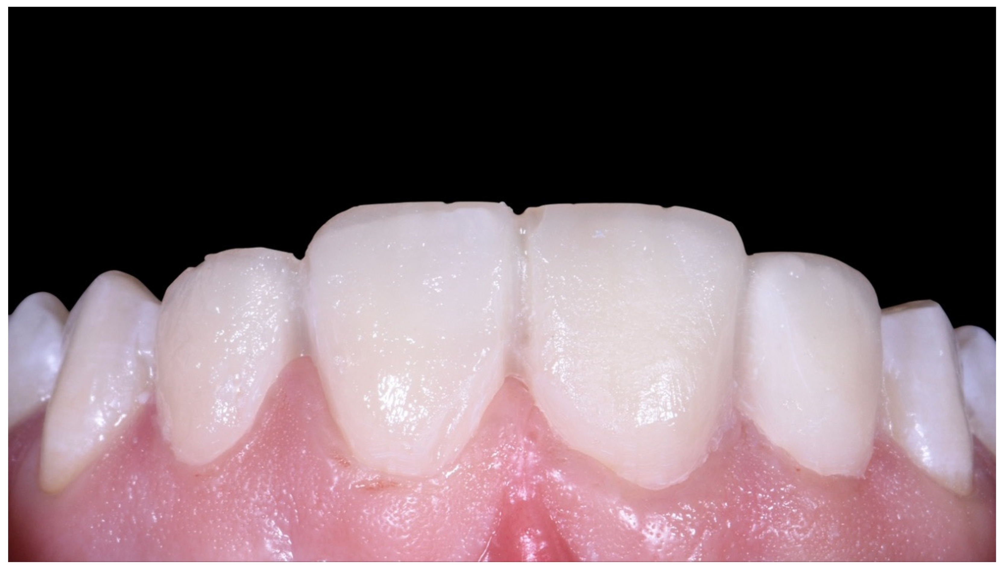 Prosthesis 02 00017 g013 Prosthesis 02 00017 g013