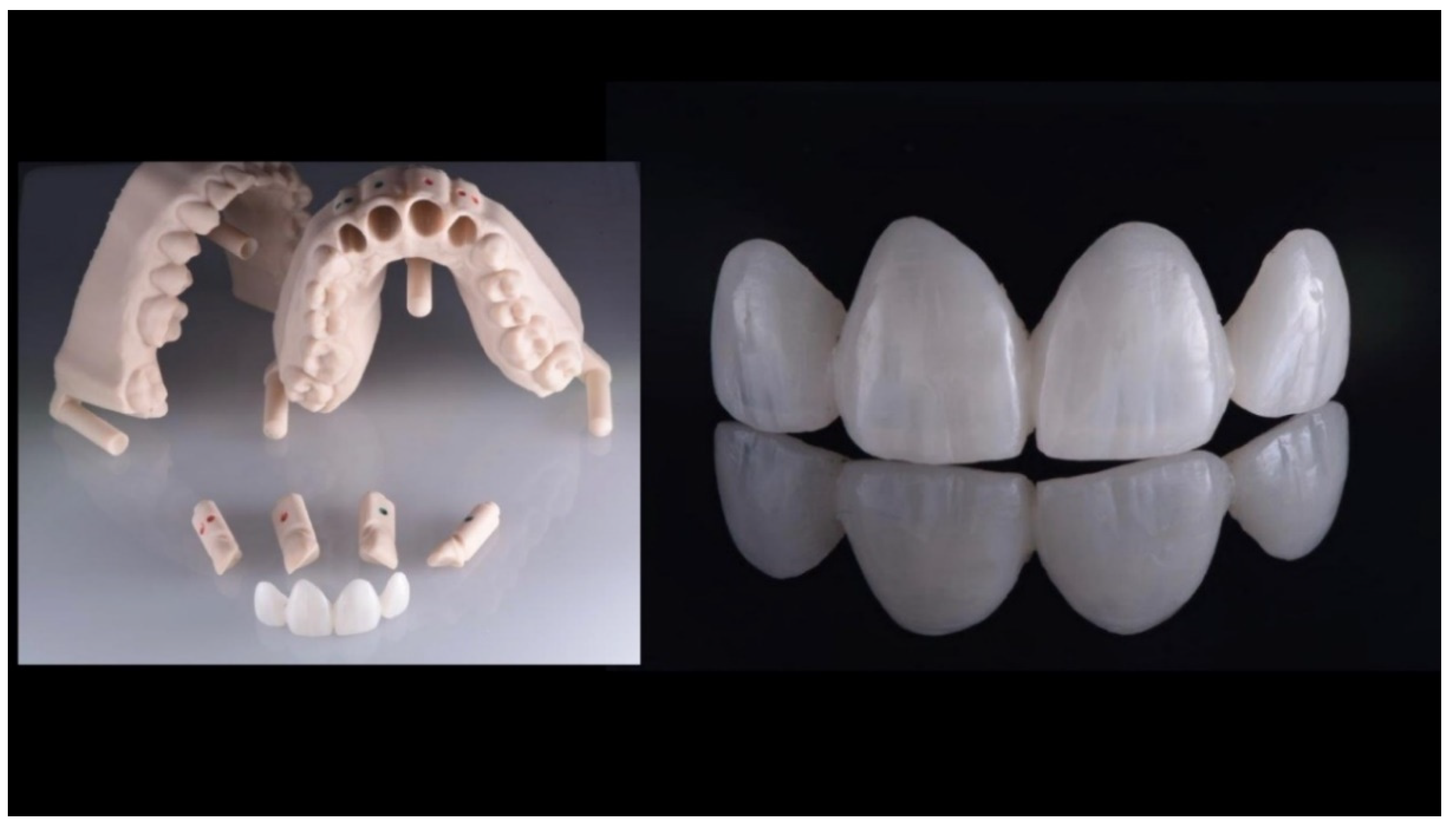 Prosthesis 02 00017 g017 Prosthesis 02 00017 g017