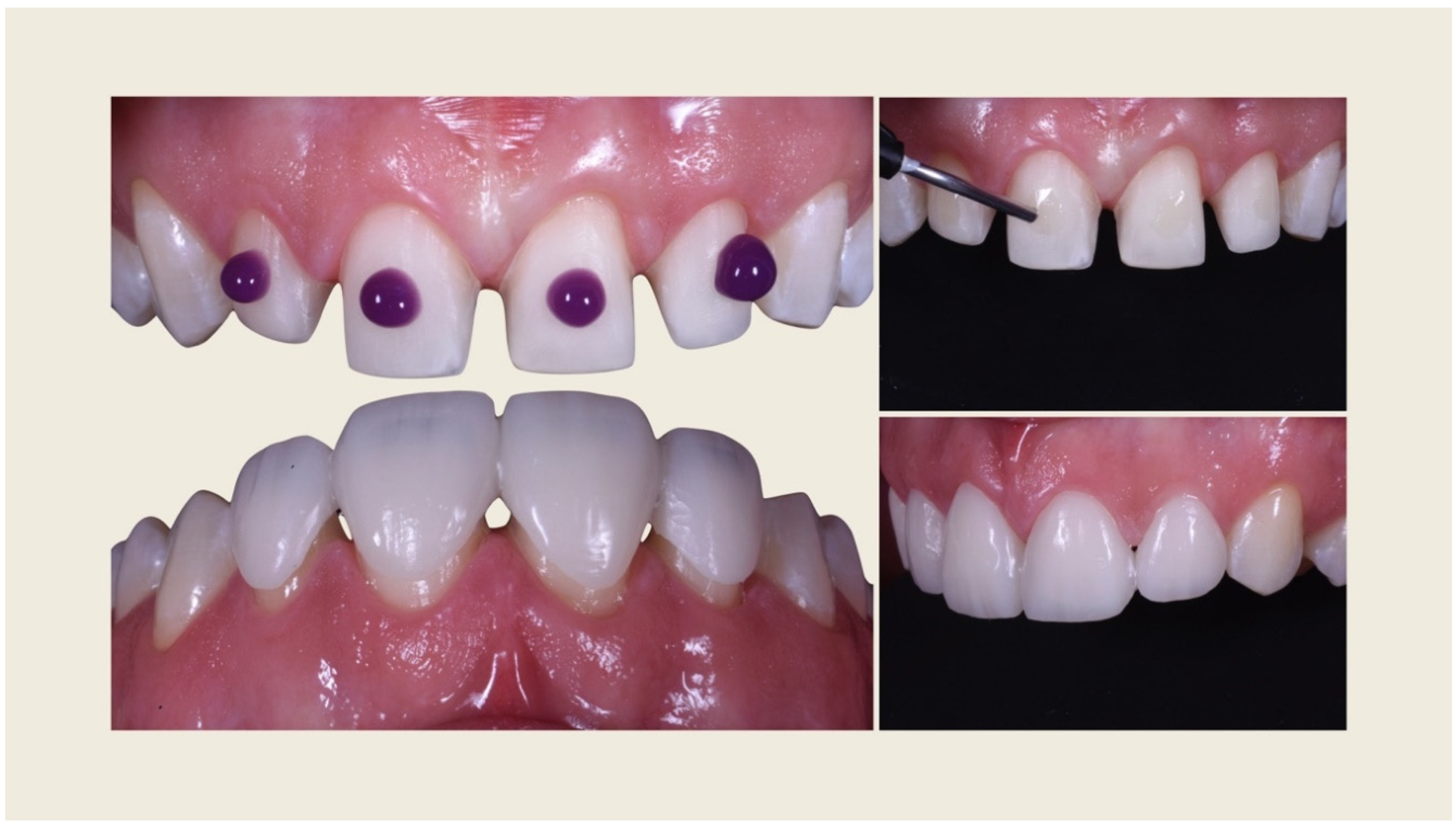 Prosthesis 02 00017 g018 Prosthesis 02 00017 g018