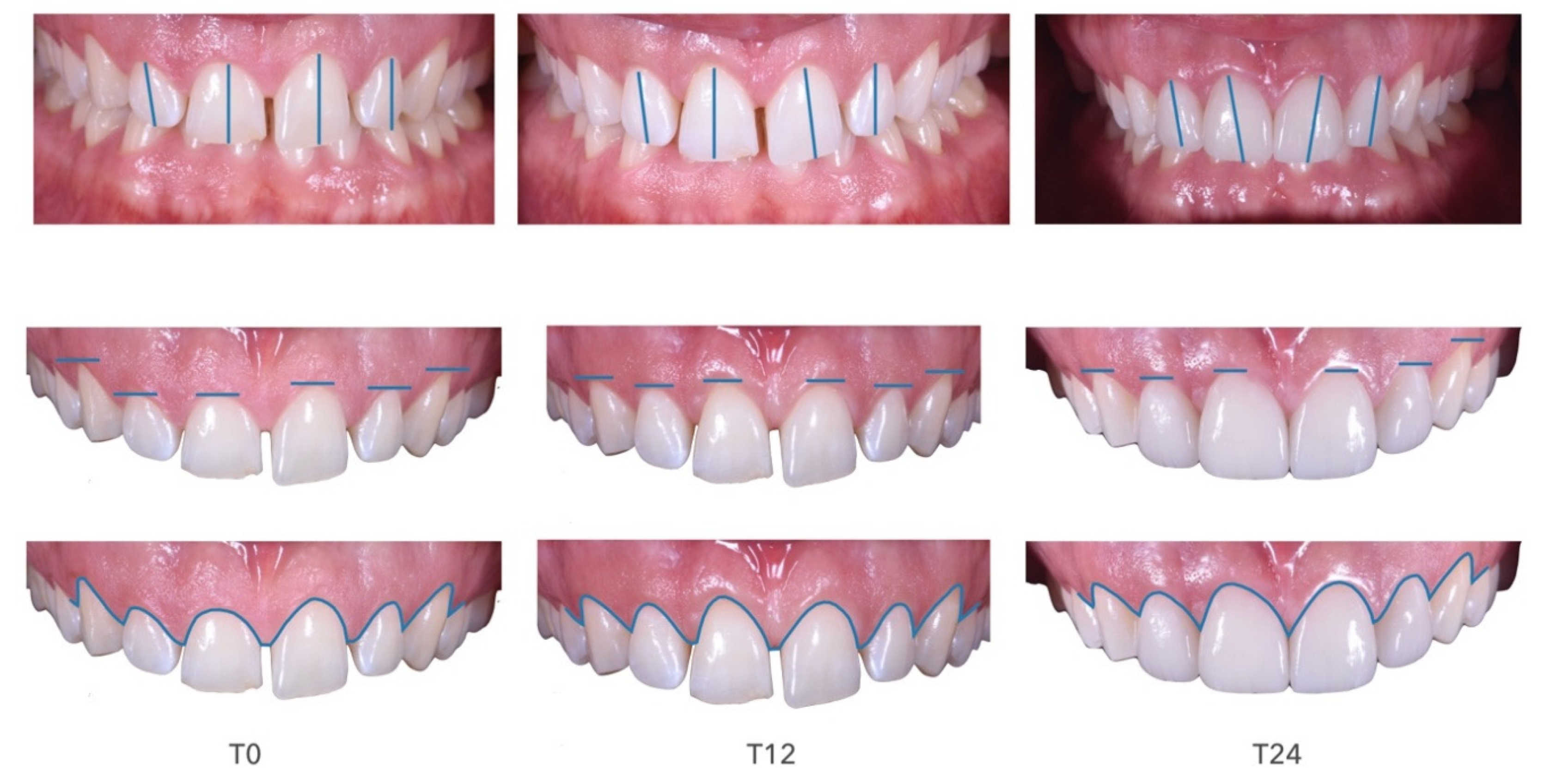 Prosthesis 02 00017 g024 Prosthesis 02 00017 g024
