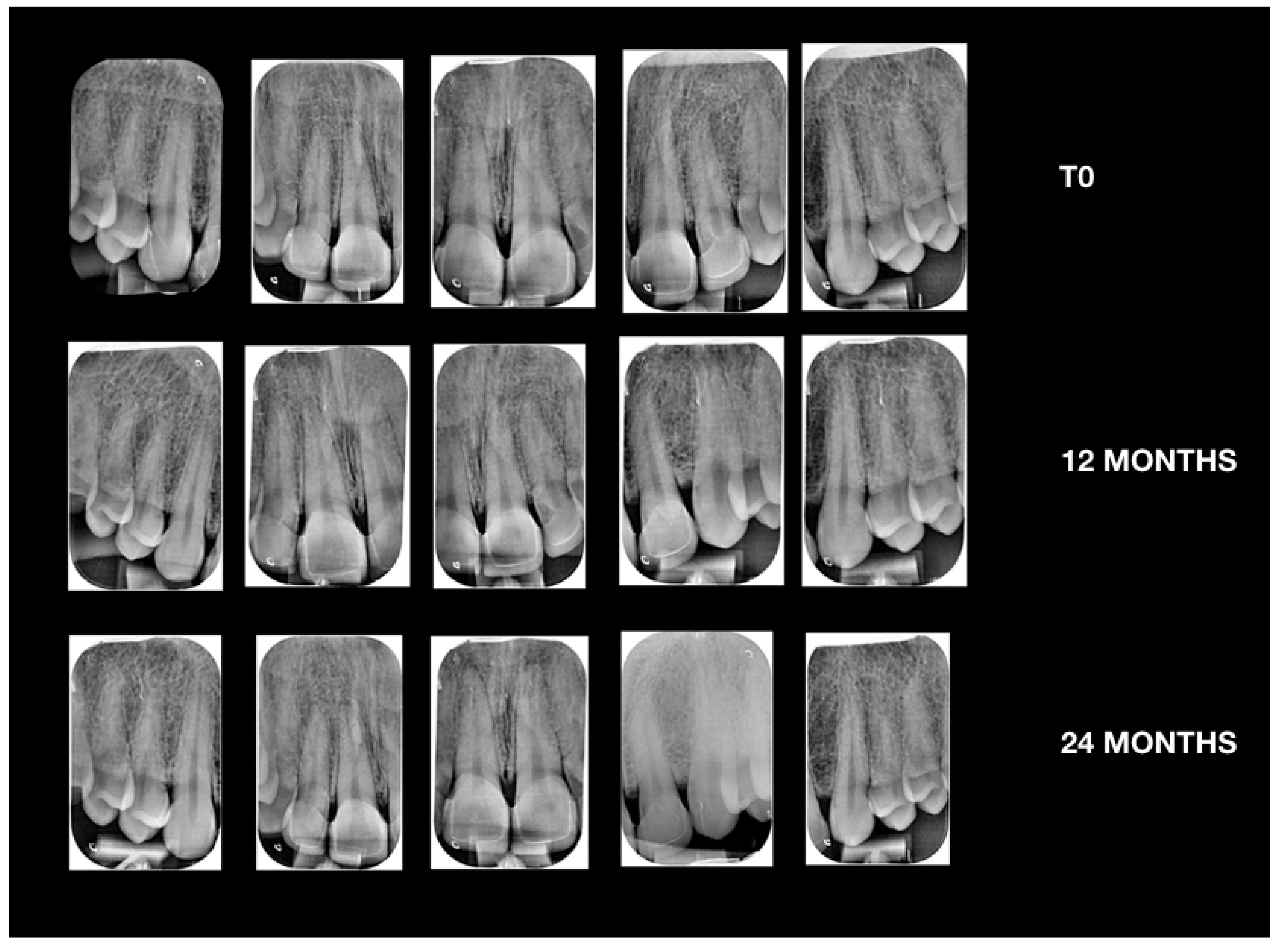Prosthesis 02 00017 g025 Prosthesis 02 00017 g025