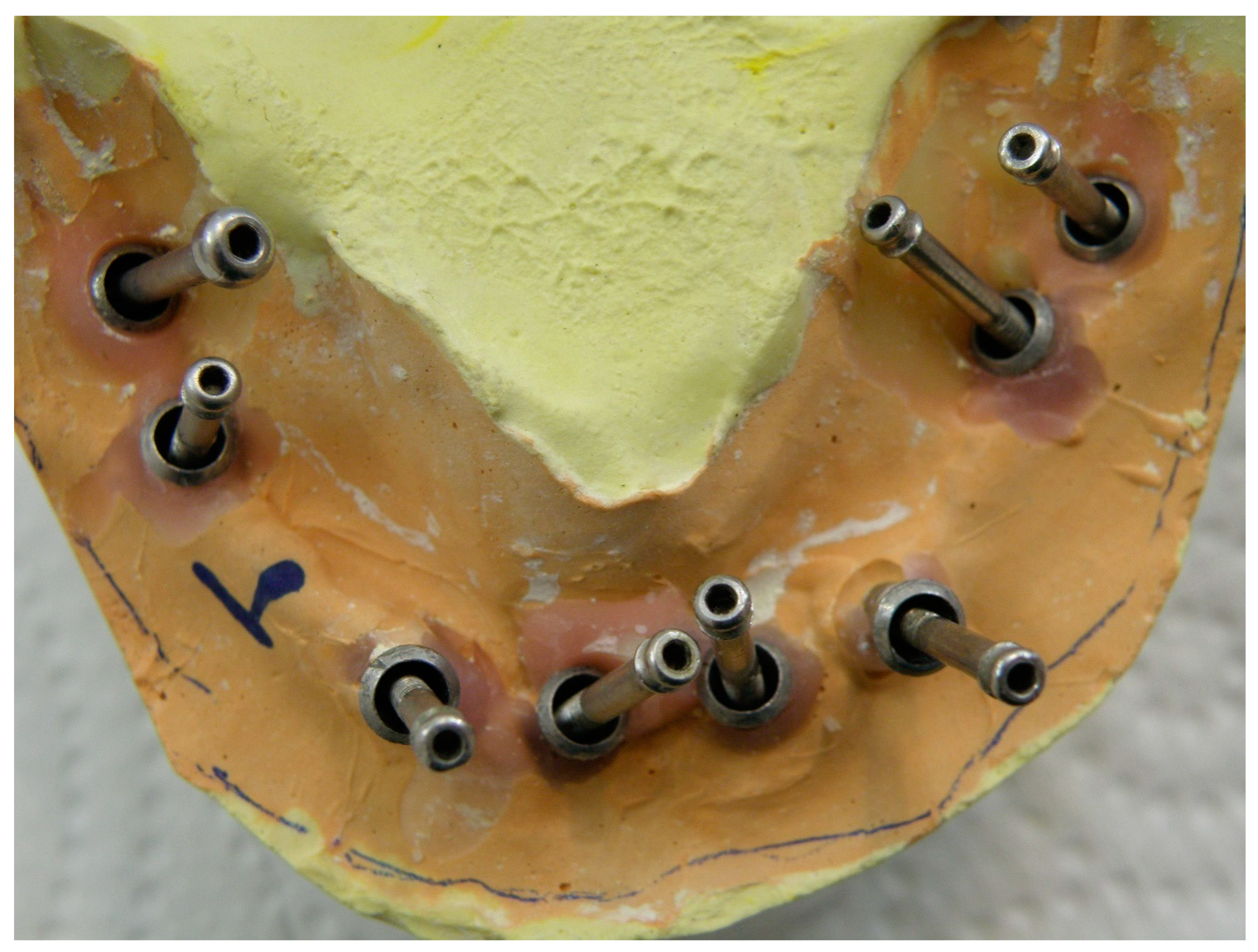 Prosthesis 02 00022 g001 Prosthesis 02 00022 g001