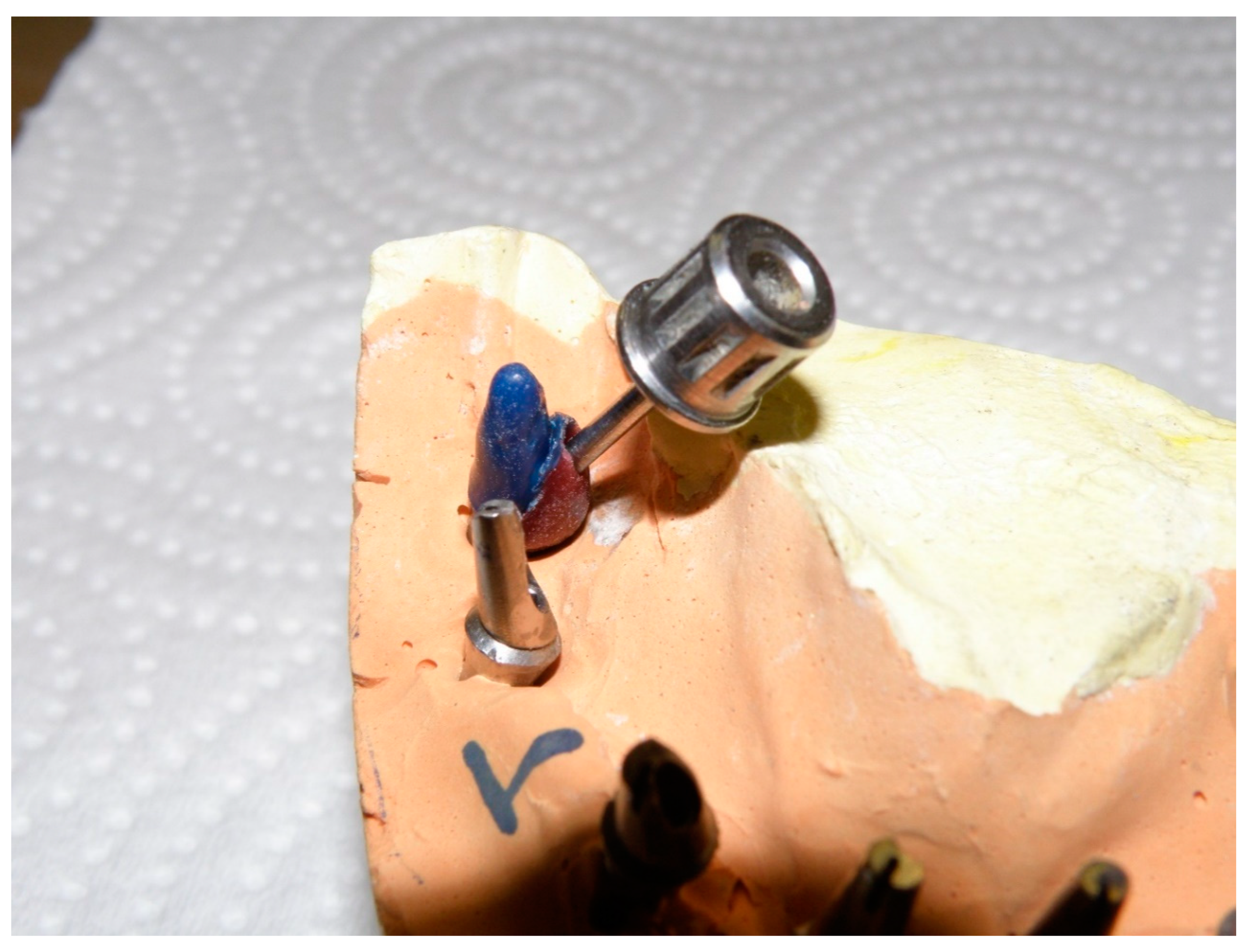 Prosthesis 02 00022 g003 Prosthesis 02 00022 g003