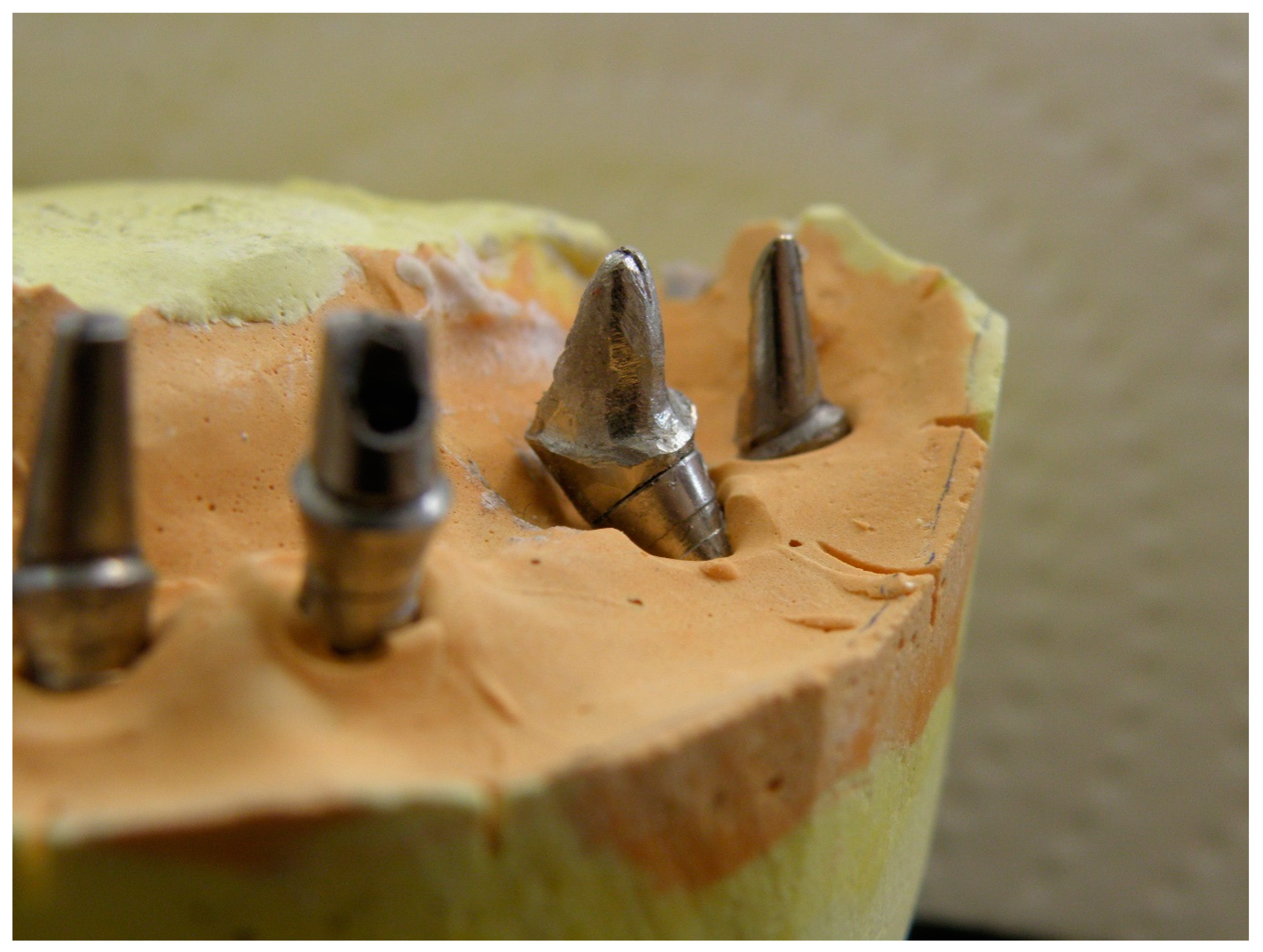 Prosthesis 02 00022 g004 Prosthesis 02 00022 g004