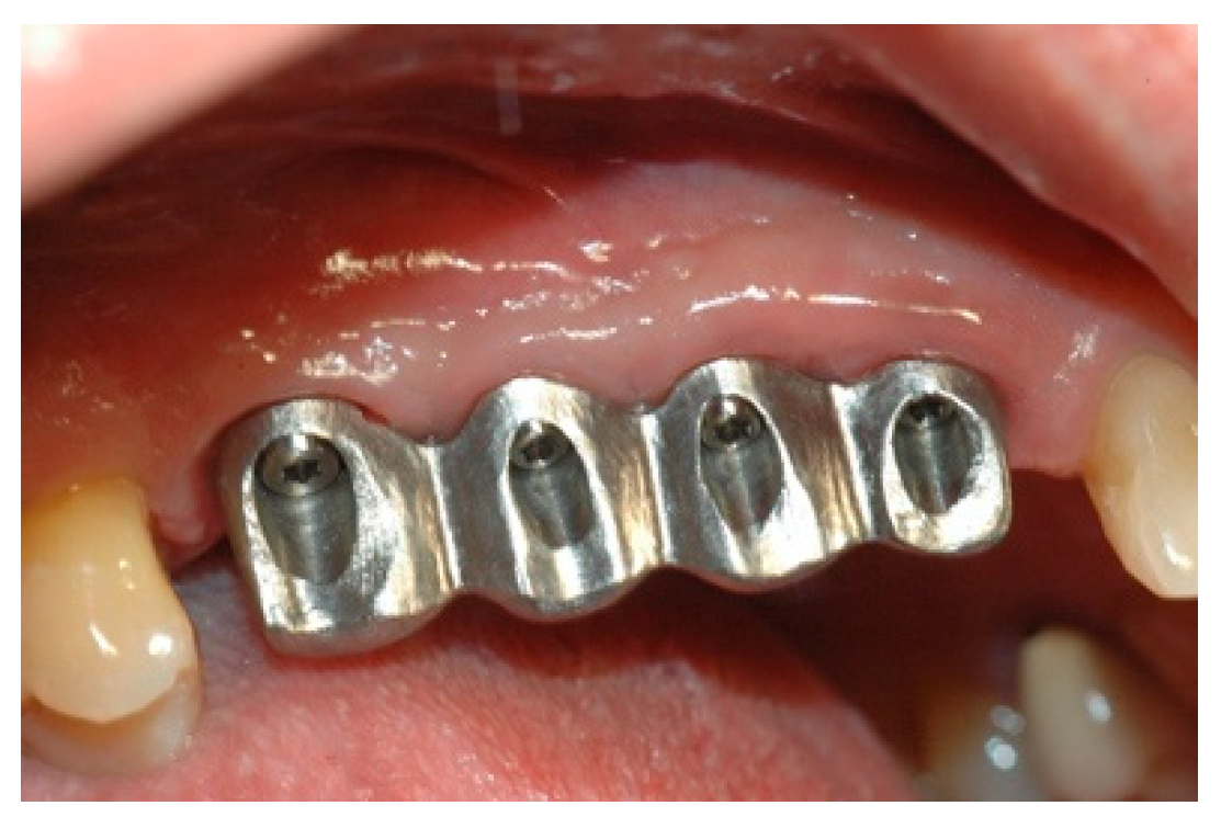 Prosthesis 02 00023 g008