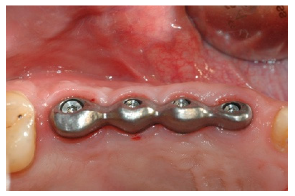 Prosthesis 02 00023 g009