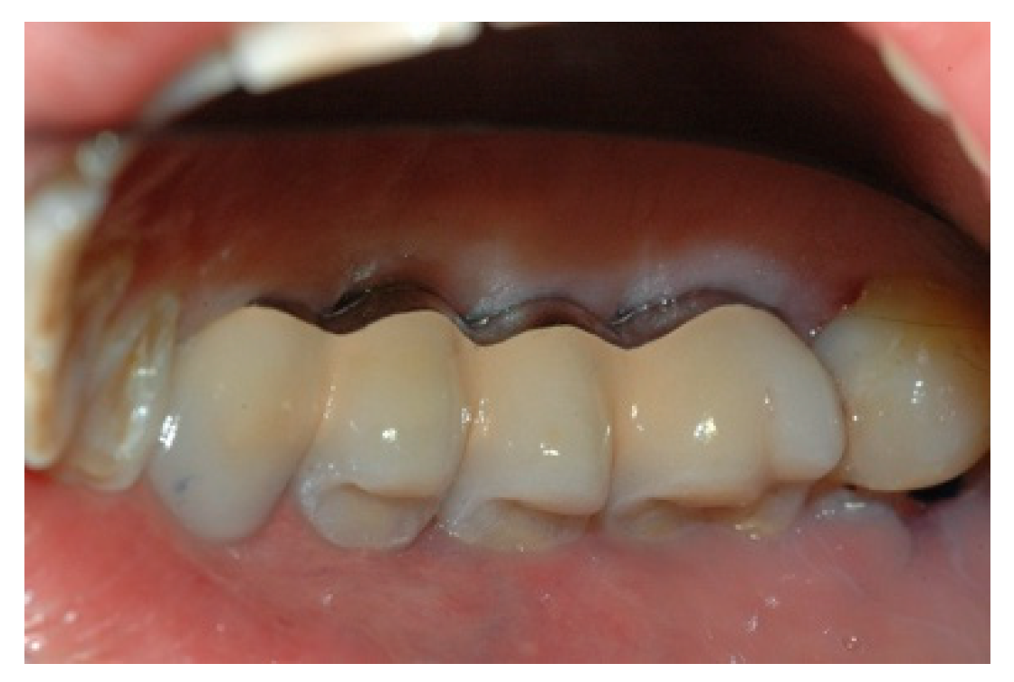 Prosthesis 02 00023 g013