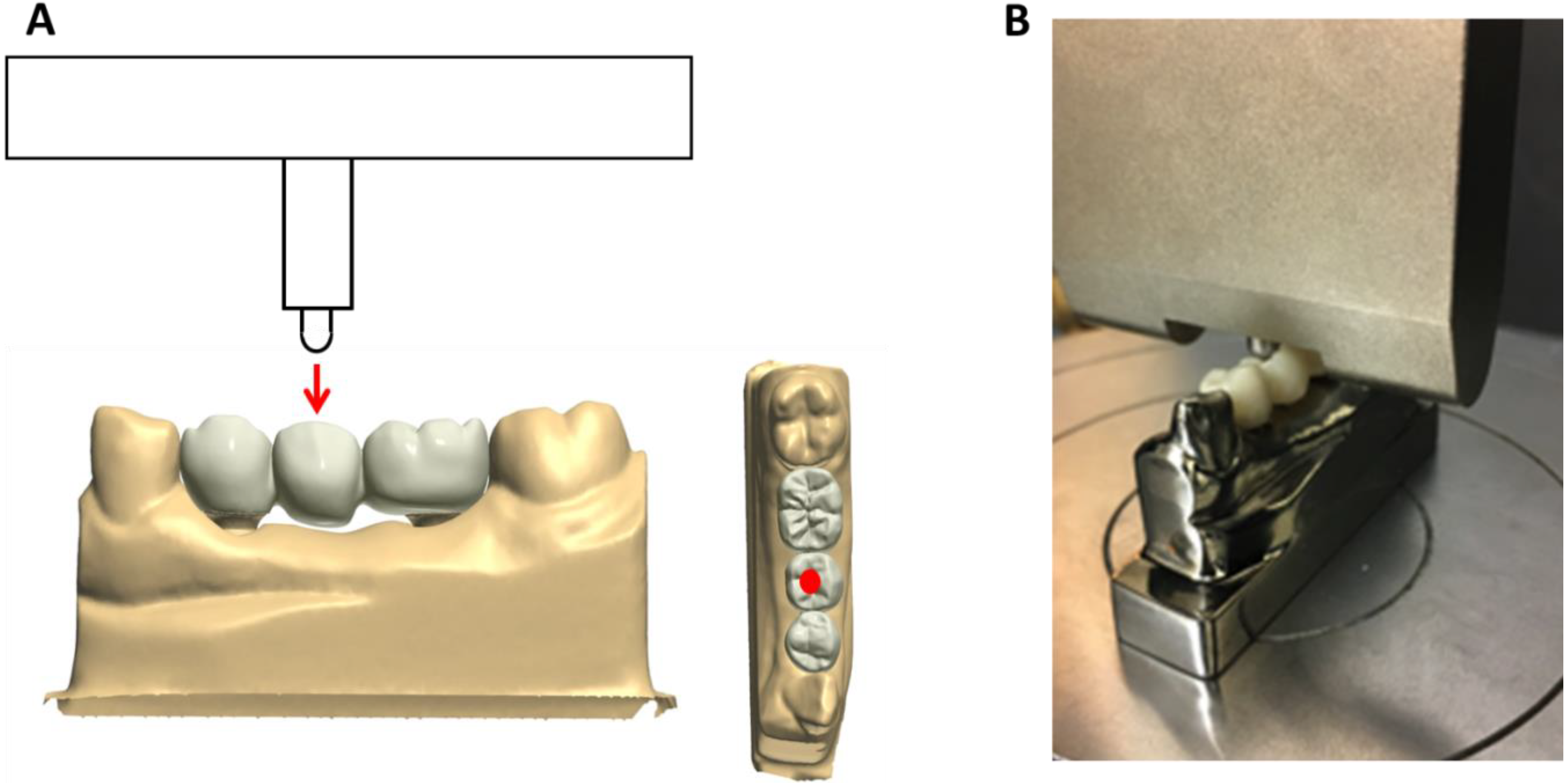 Prosthesis 02 00030 g002 Prosthesis 02 00030 g002