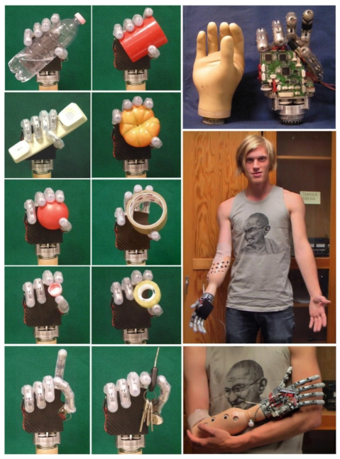 Can Prosthetic Hands Mimic a Healthy Human Hand?