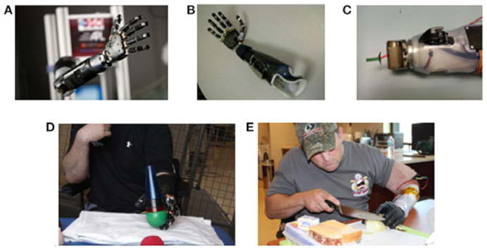 Prosthesis 03 00003 g004