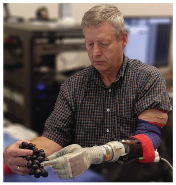 Prosthesis 03 00003 g005