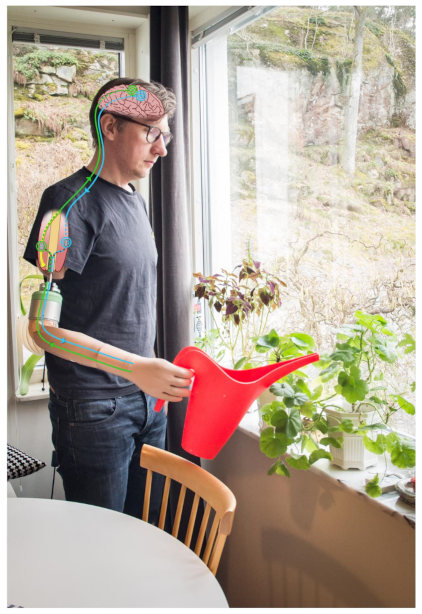 Prosthesis 03 00003 g008