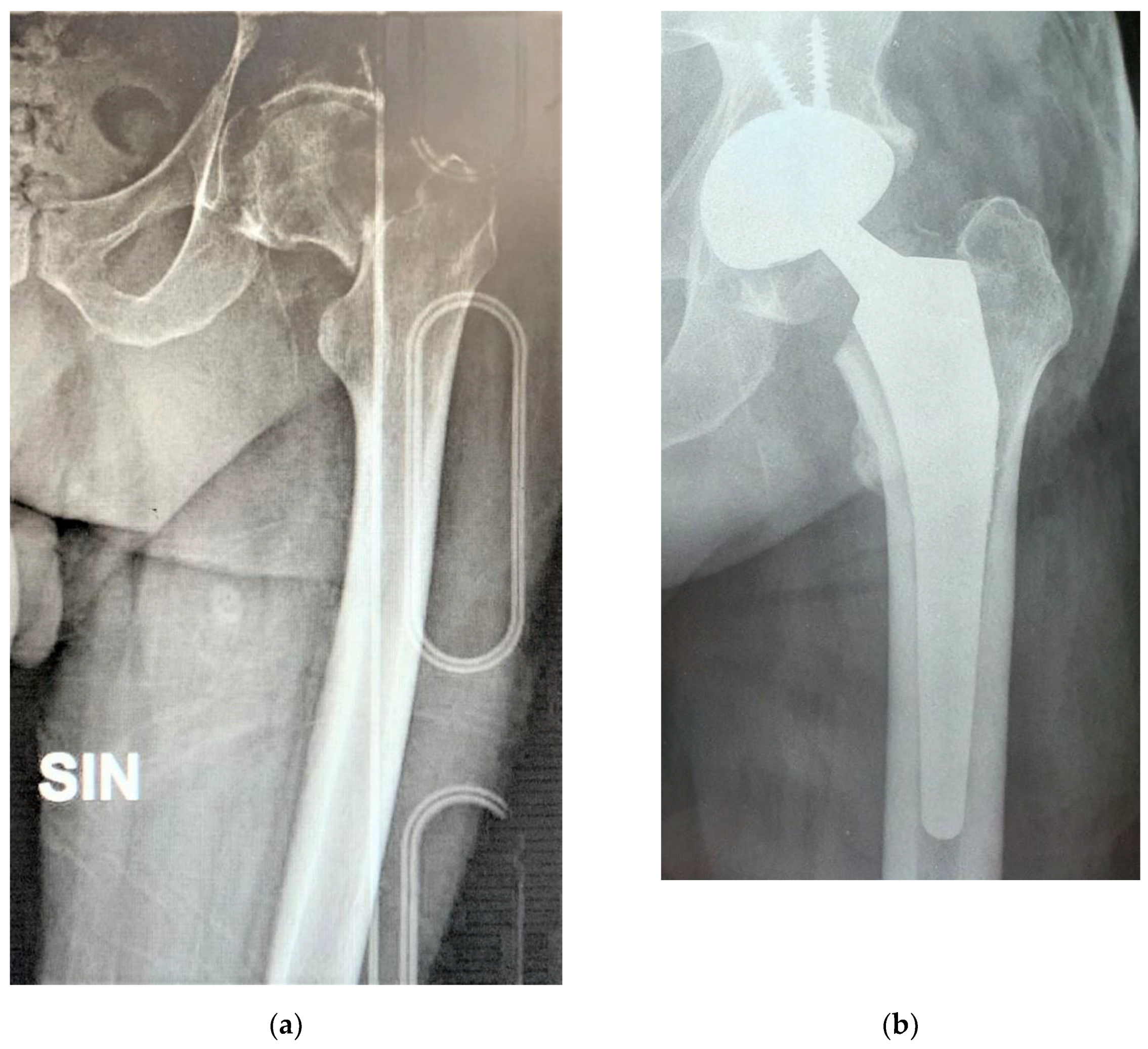 Prosthesis 03 00006 g002 Prosthesis 03 00006 g002