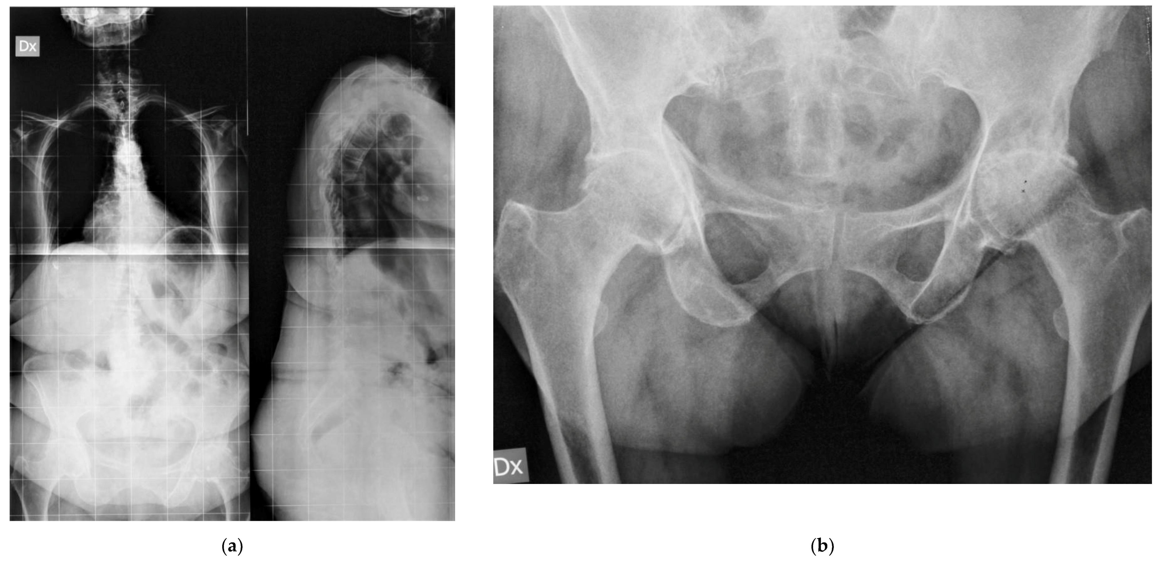 Prosthesis 03 00006 g003a Prosthesis 03 00006 g003a