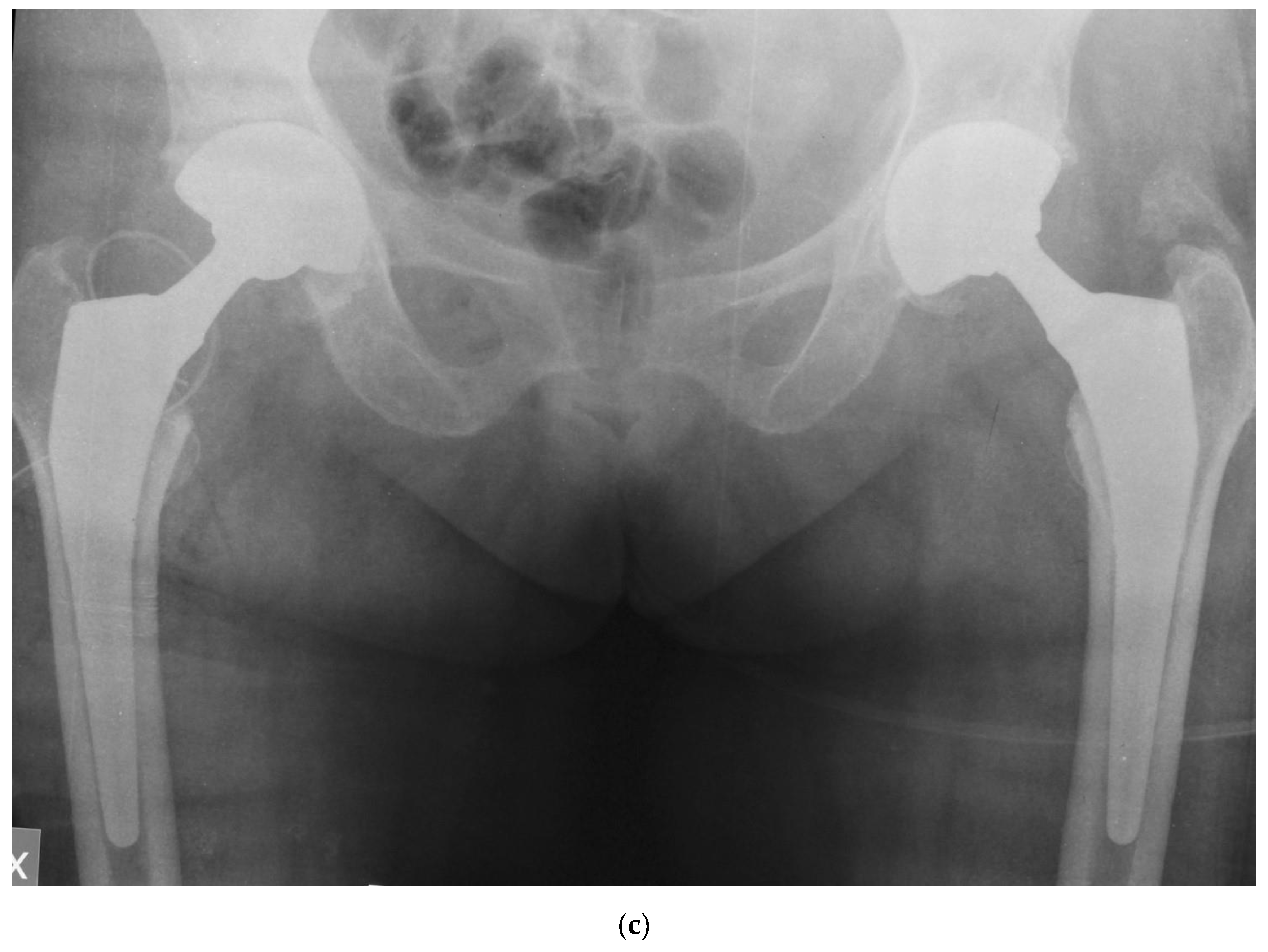Prosthesis 03 00006 g003b Prosthesis 03 00006 g003b