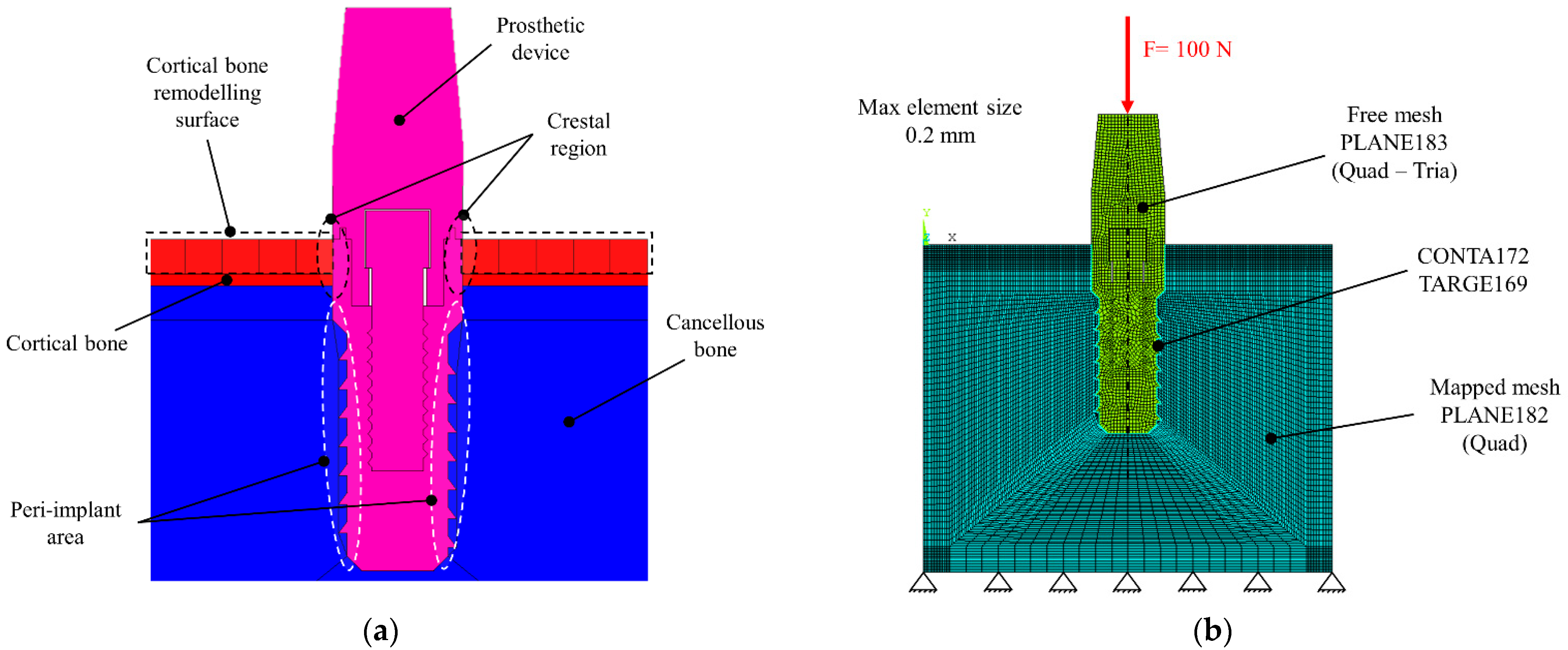Prosthesis 03 00016 g002 Prosthesis 03 00016 g002