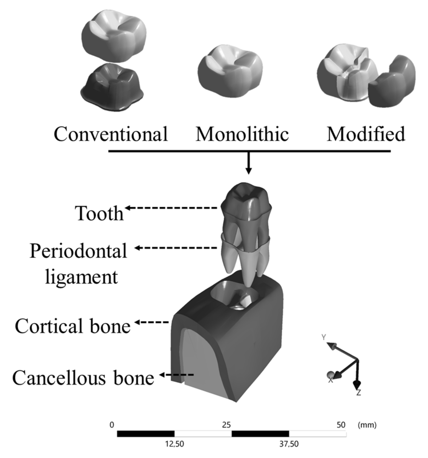 Prosthesis 03 00017 g001 Prosthesis 03 00017 g001