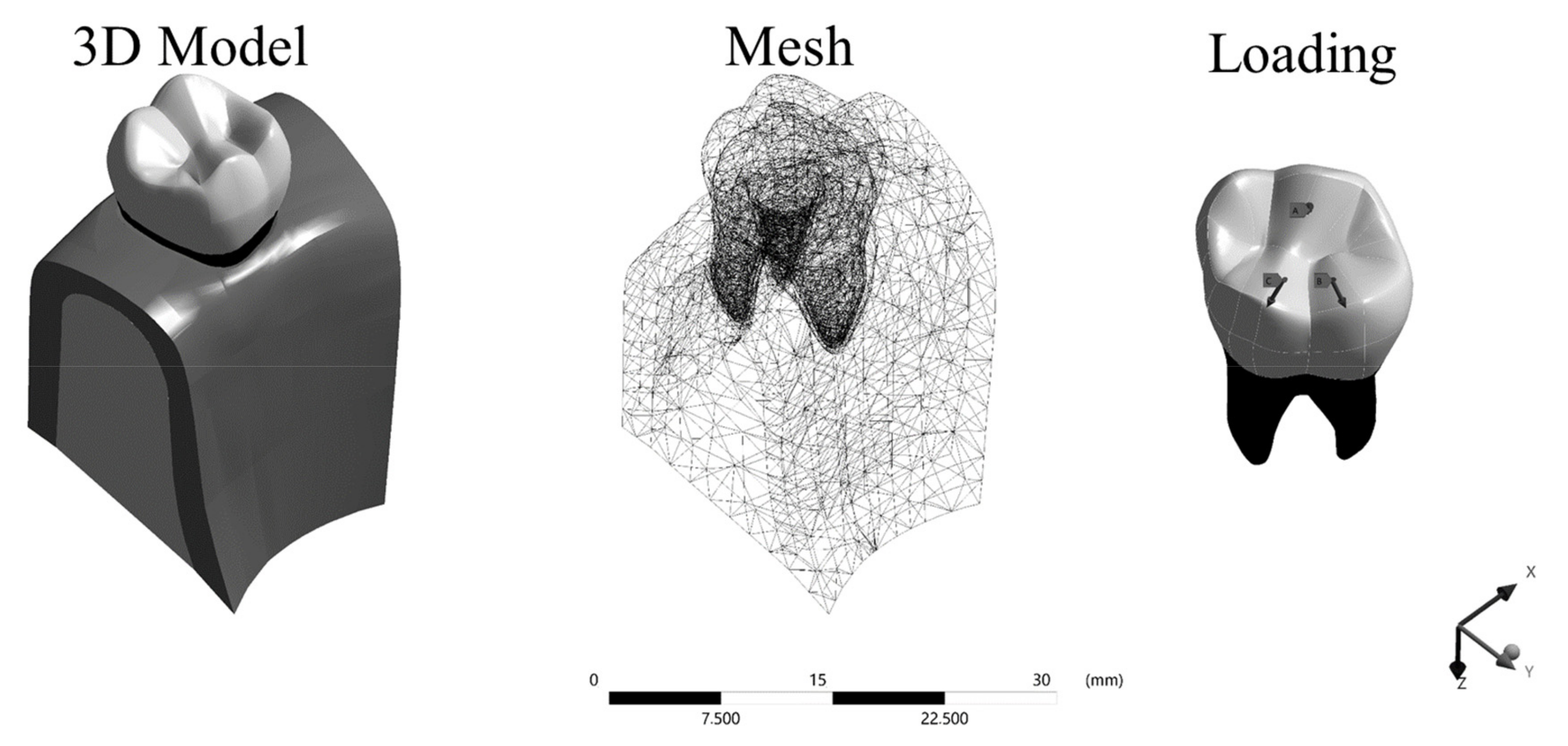 Prosthesis 03 00017 g002 Prosthesis 03 00017 g002