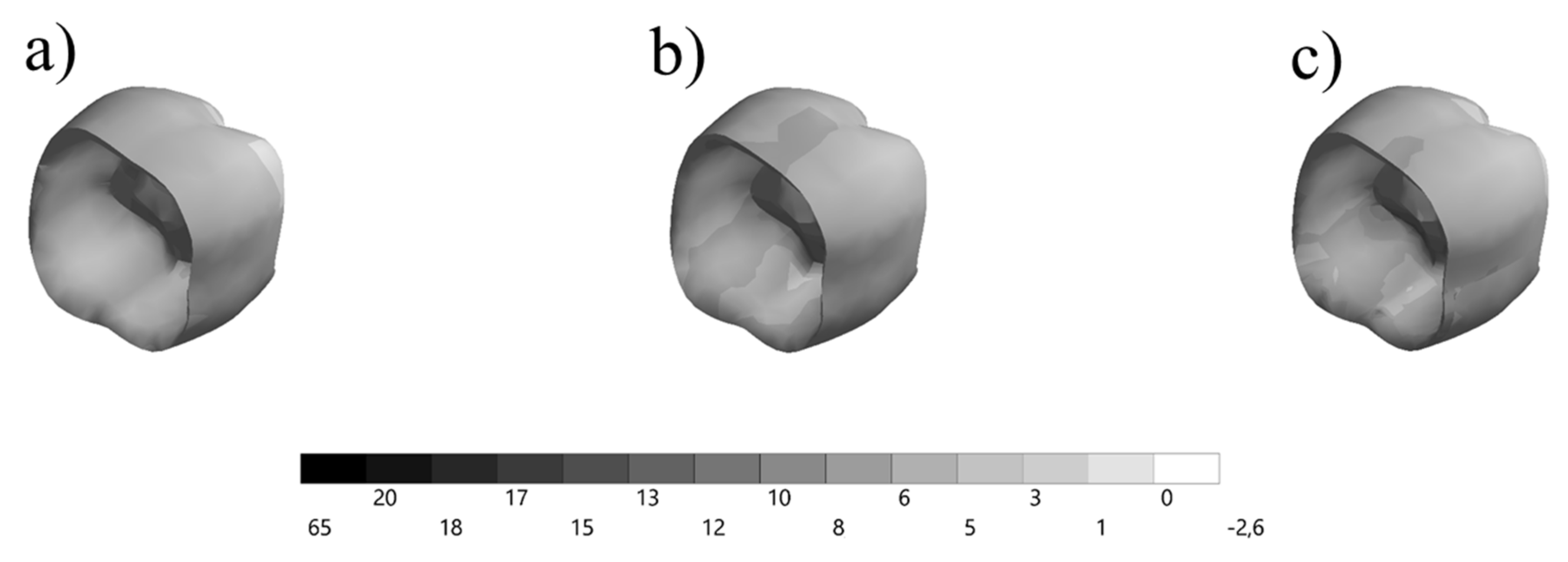 Prosthesis 03 00017 g003 Prosthesis 03 00017 g003