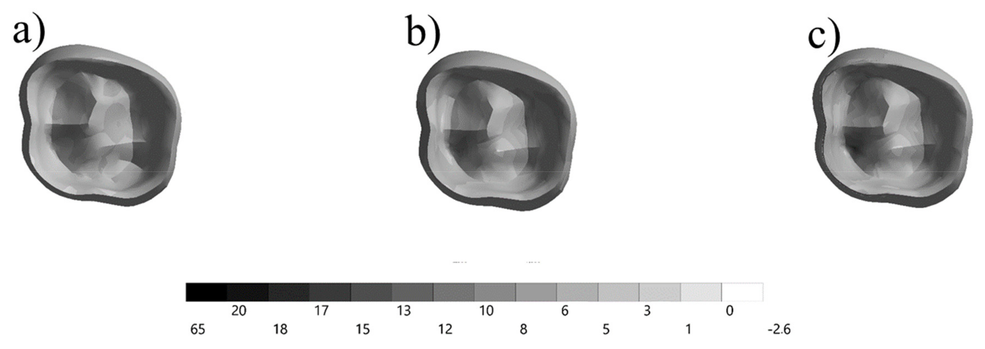 Prosthesis 03 00017 g004 Prosthesis 03 00017 g004