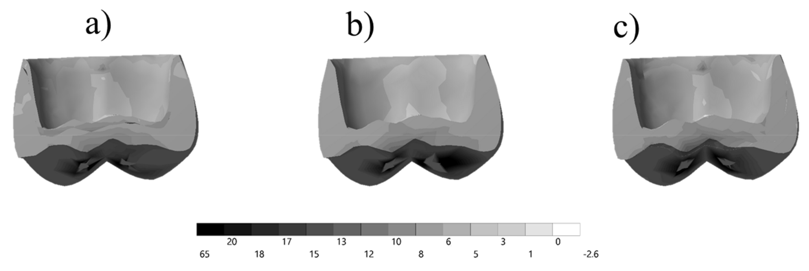 Prosthesis 03 00017 g005 Prosthesis 03 00017 g005