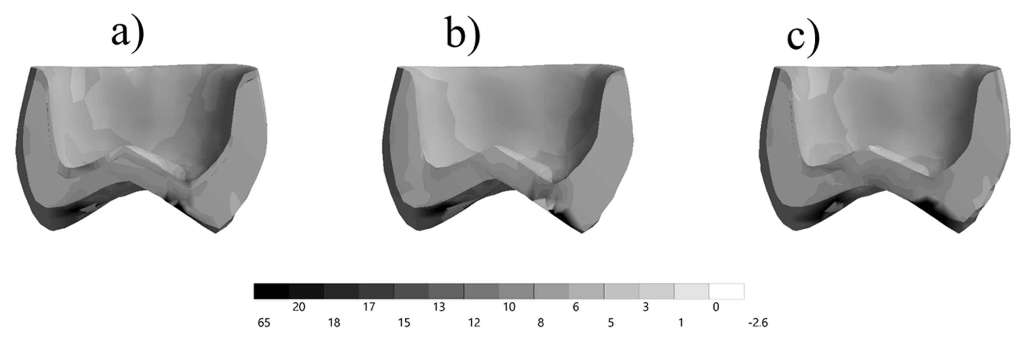 Prosthesis 03 00017 g006 Prosthesis 03 00017 g006