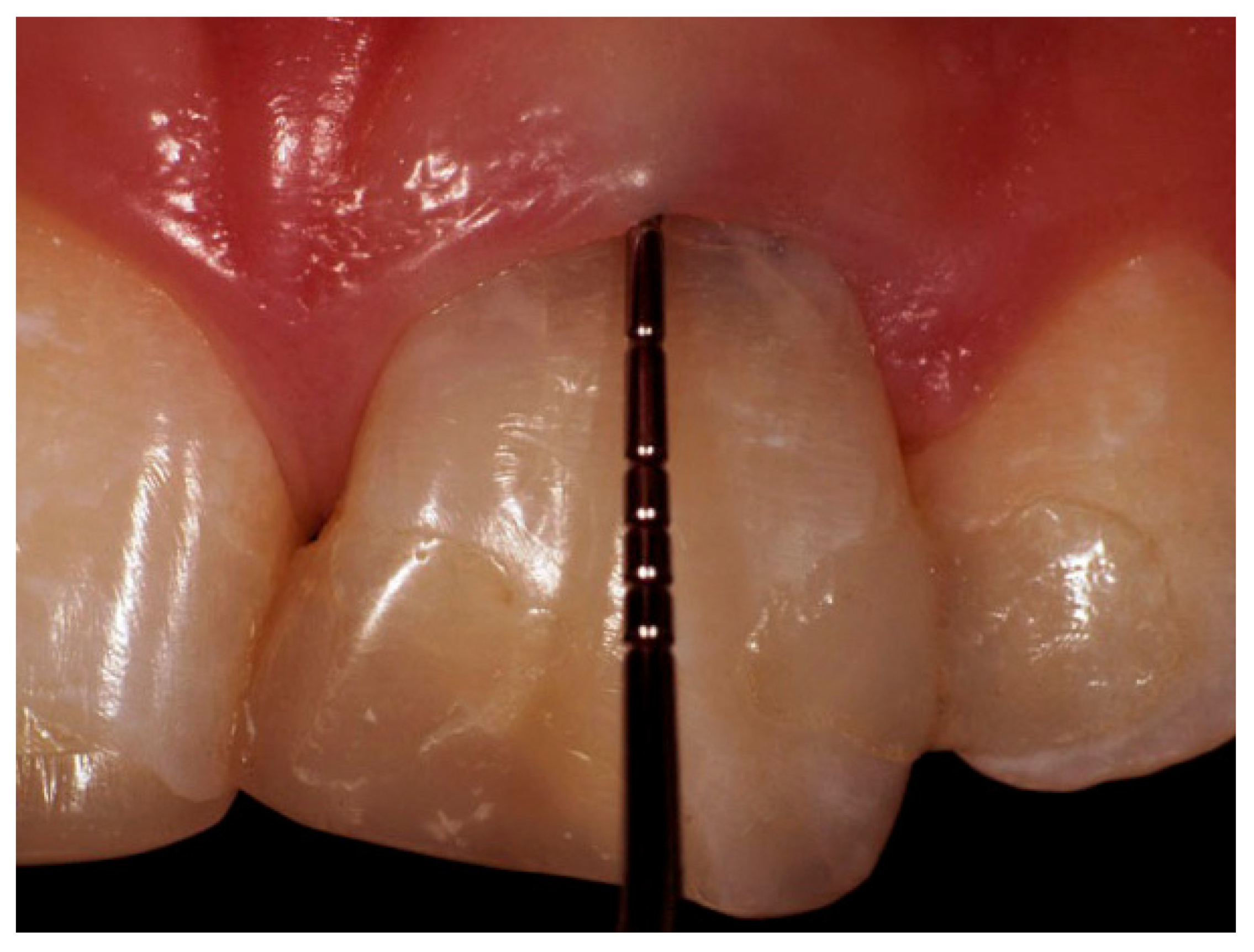 Prosthesis 03 00021 g001 550