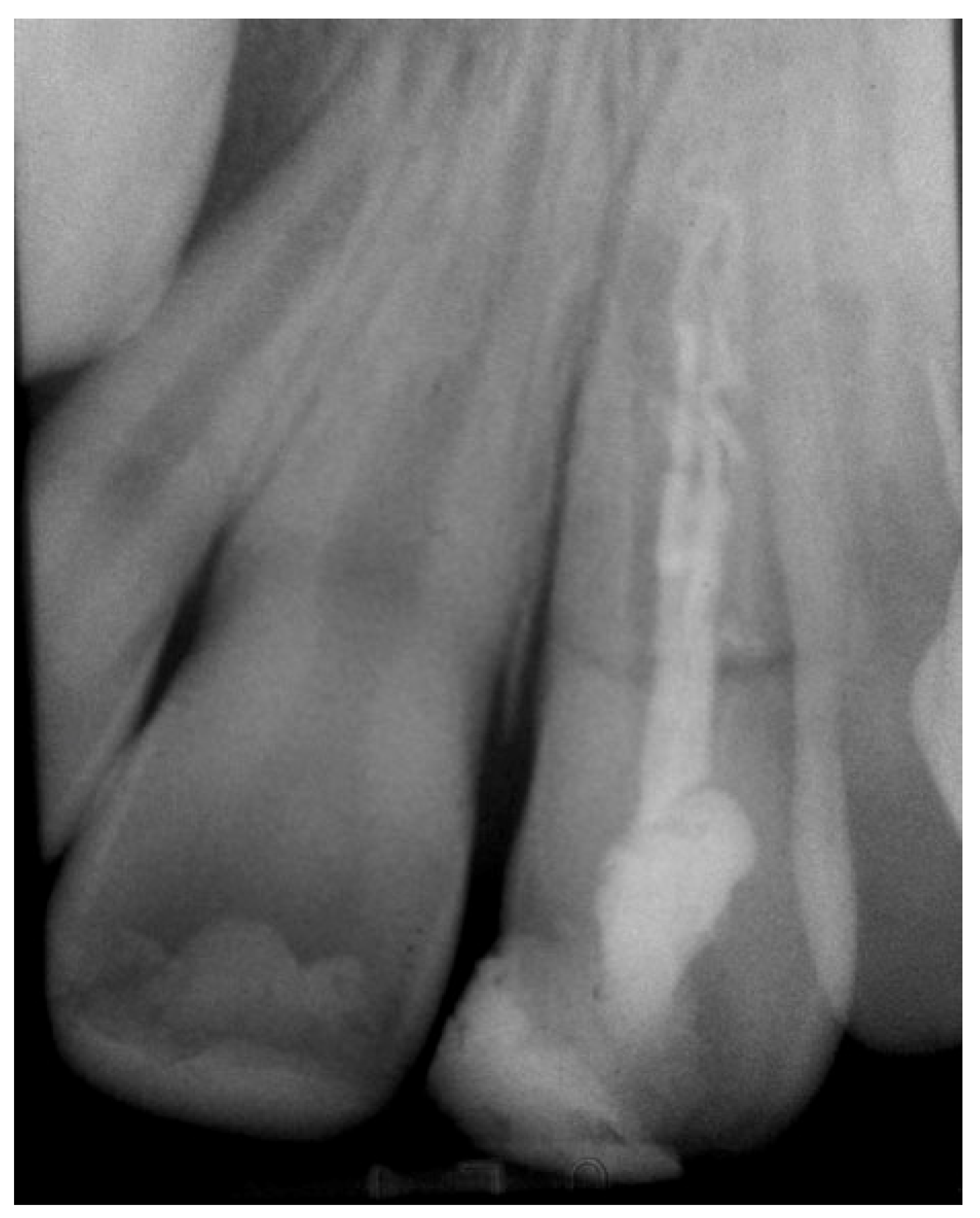 Prosthesis 03 00021 g002 550