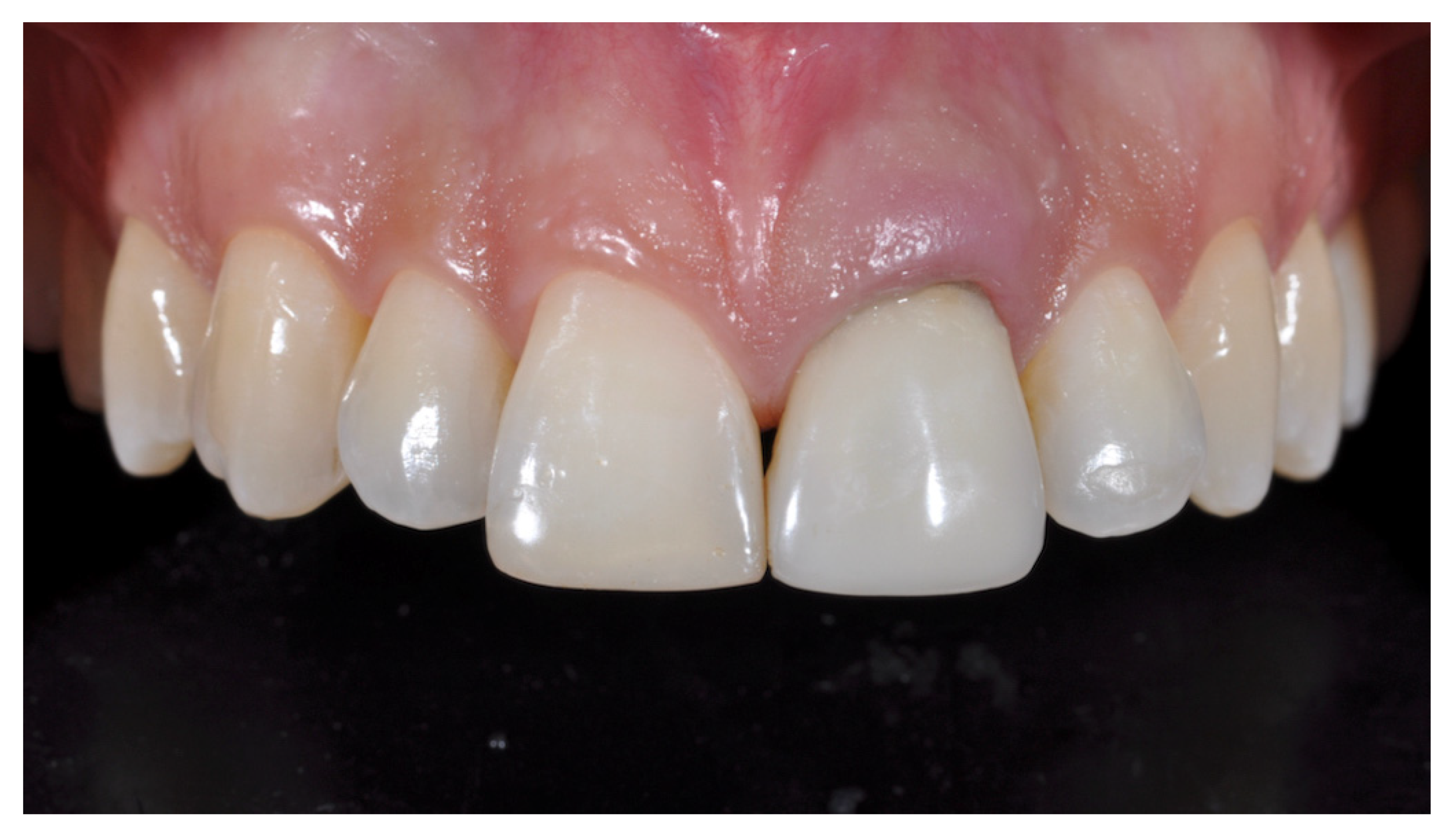 Prosthesis 03 00021 g003 550