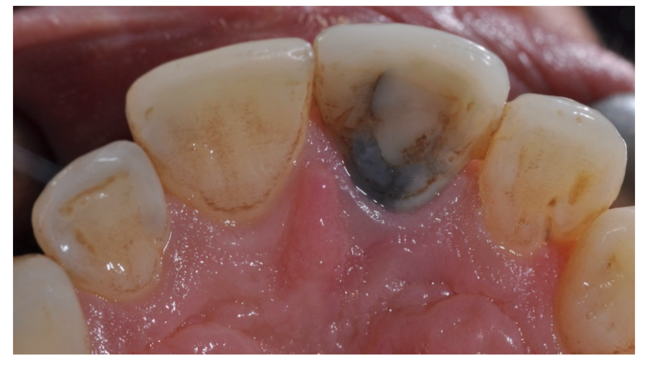 Prosthesis 03 00021 g004 550