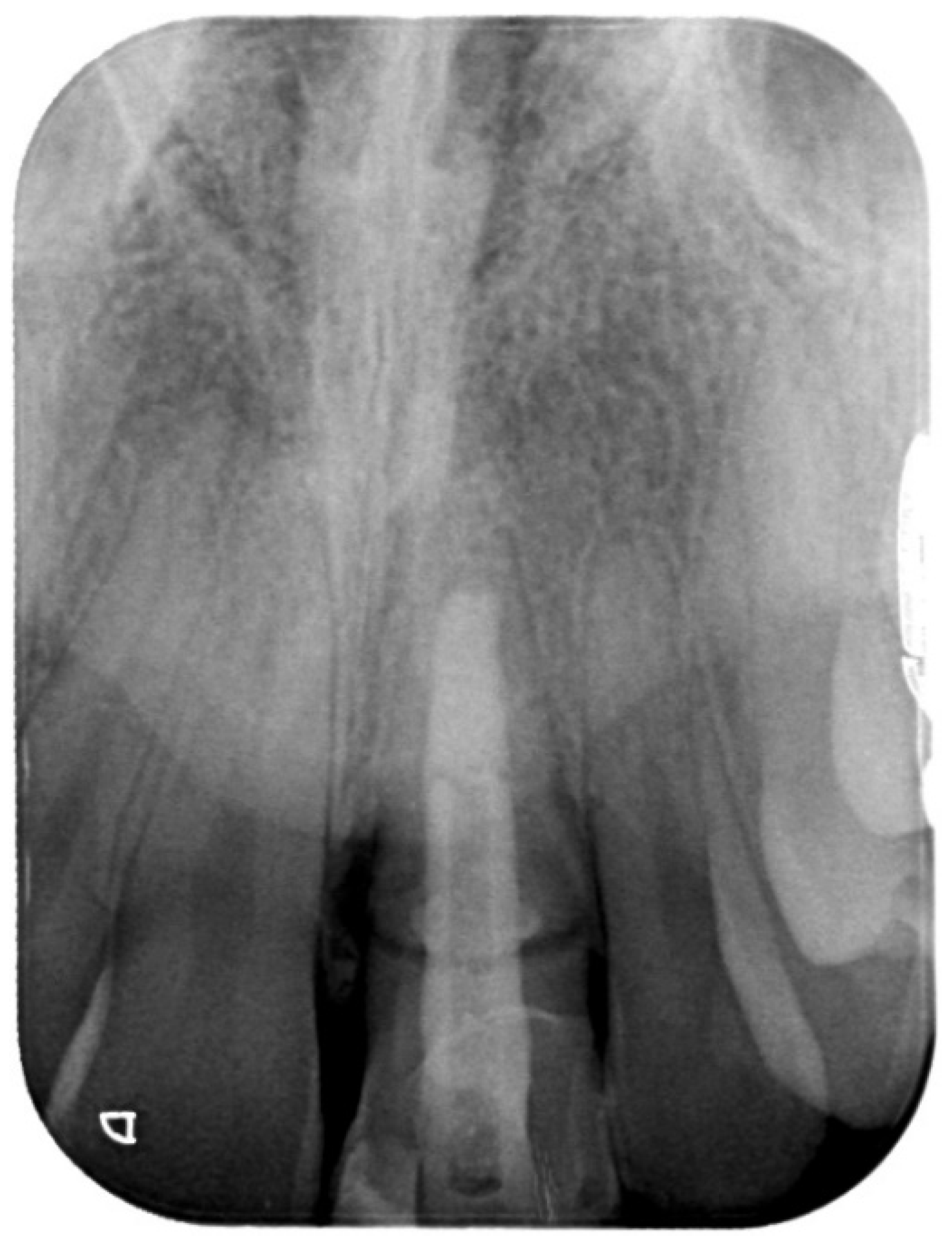 Prosthesis 03 00021 g005 550