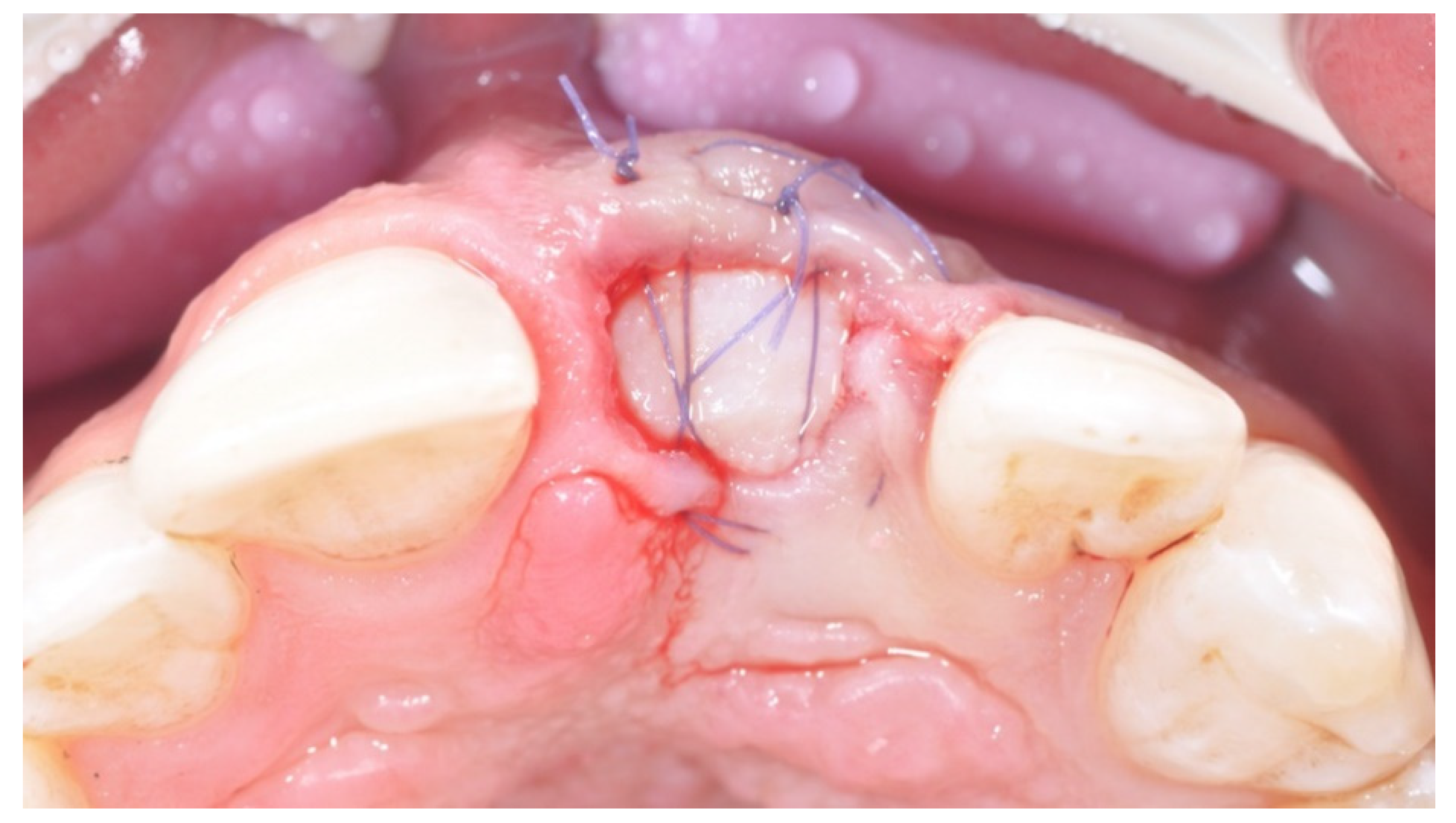 Prosthesis 03 00021 g006 550