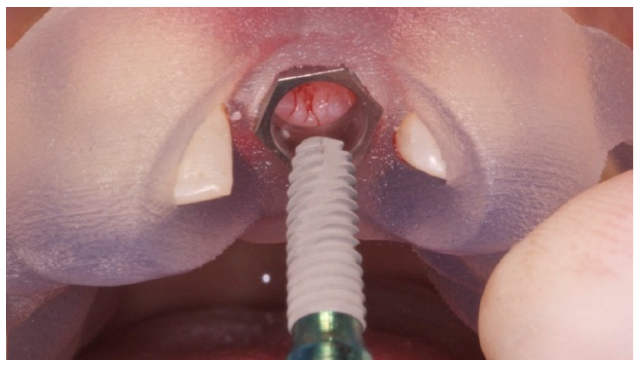 Prosthesis 03 00021 g007 550