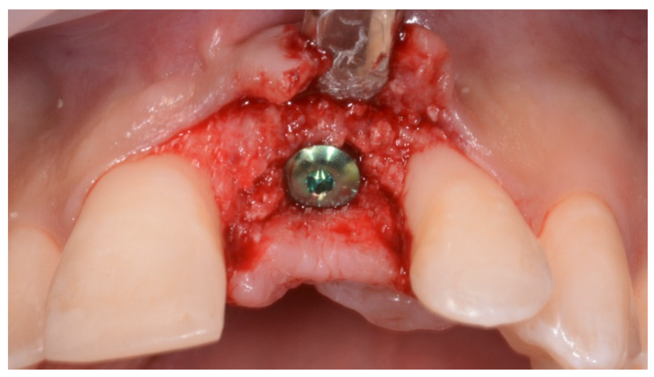 Prosthesis 03 00021 g008 550