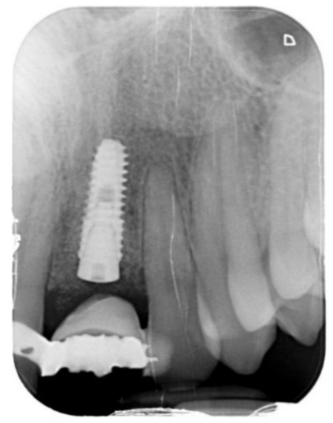 Prosthesis 03 00021 g009 550