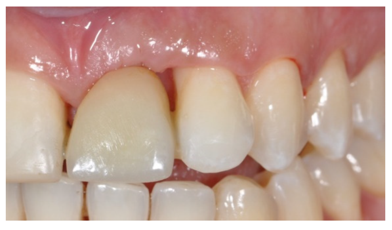 Prosthesis 03 00021 g010 550