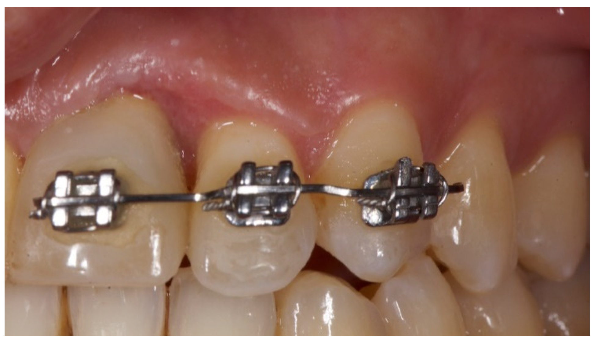 Prosthesis 03 00021 g011 550