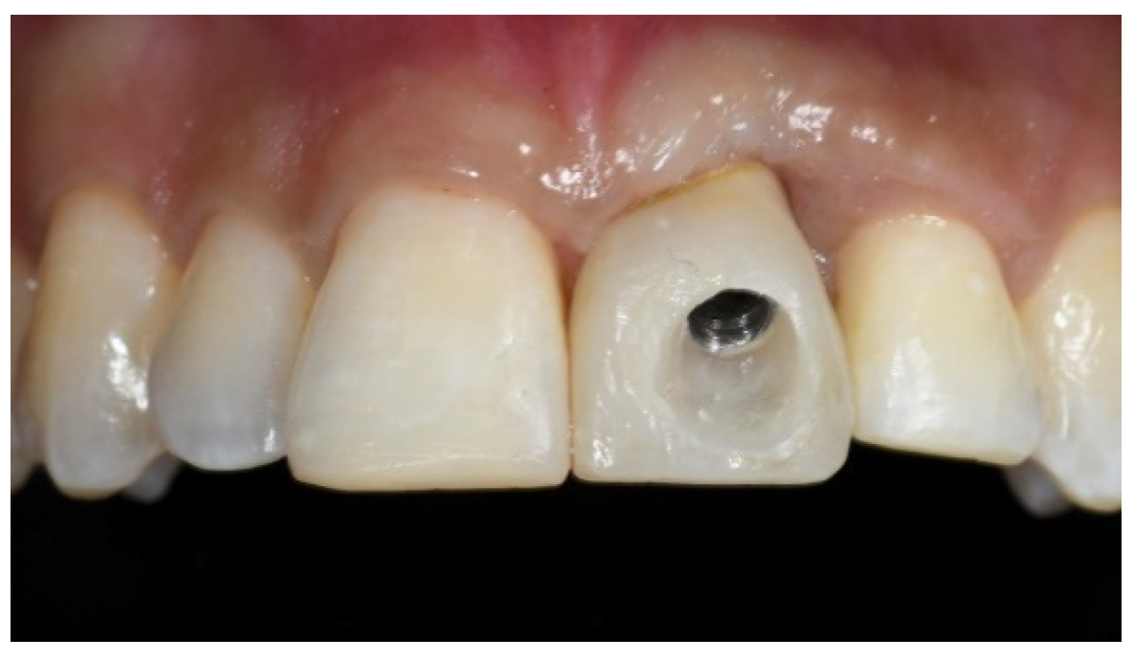 Prosthesis 03 00021 g012 550