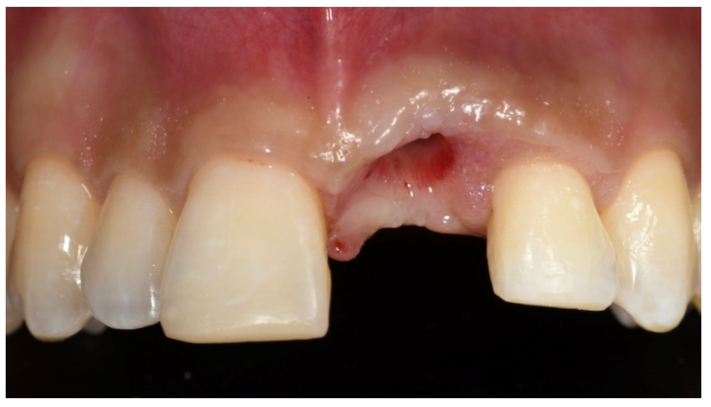 Prosthesis 03 00021 g013 550