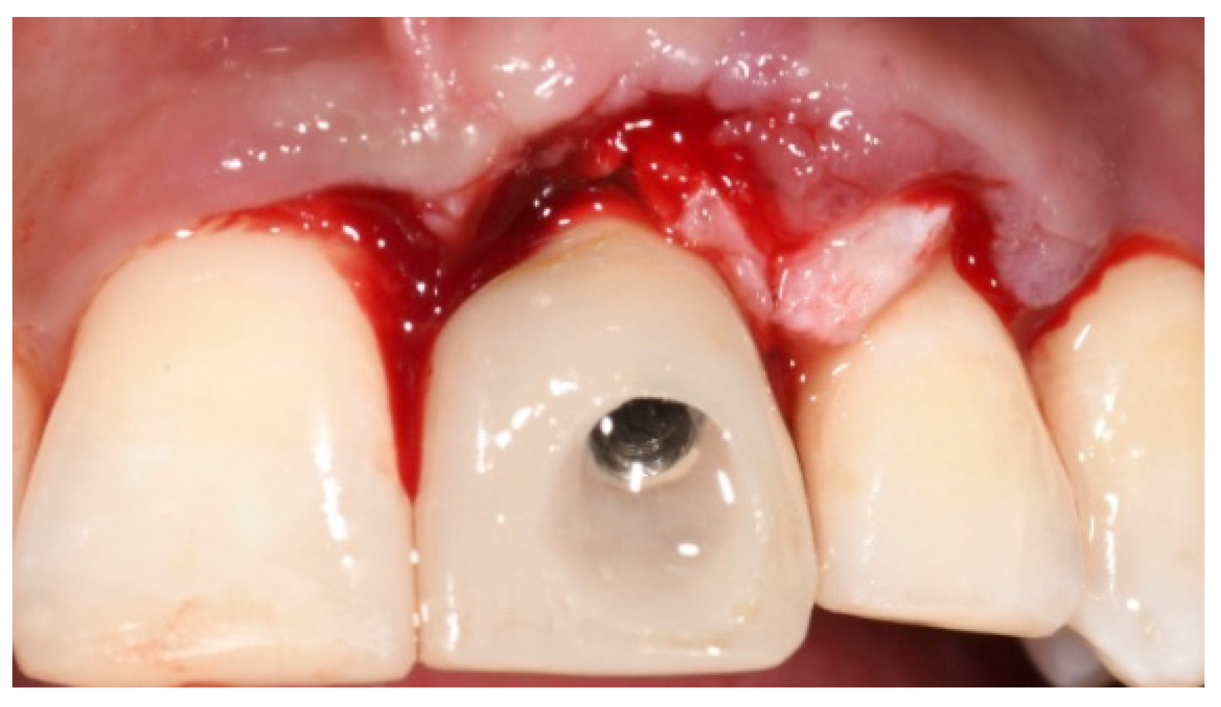 Prosthesis 03 00021 g014 550