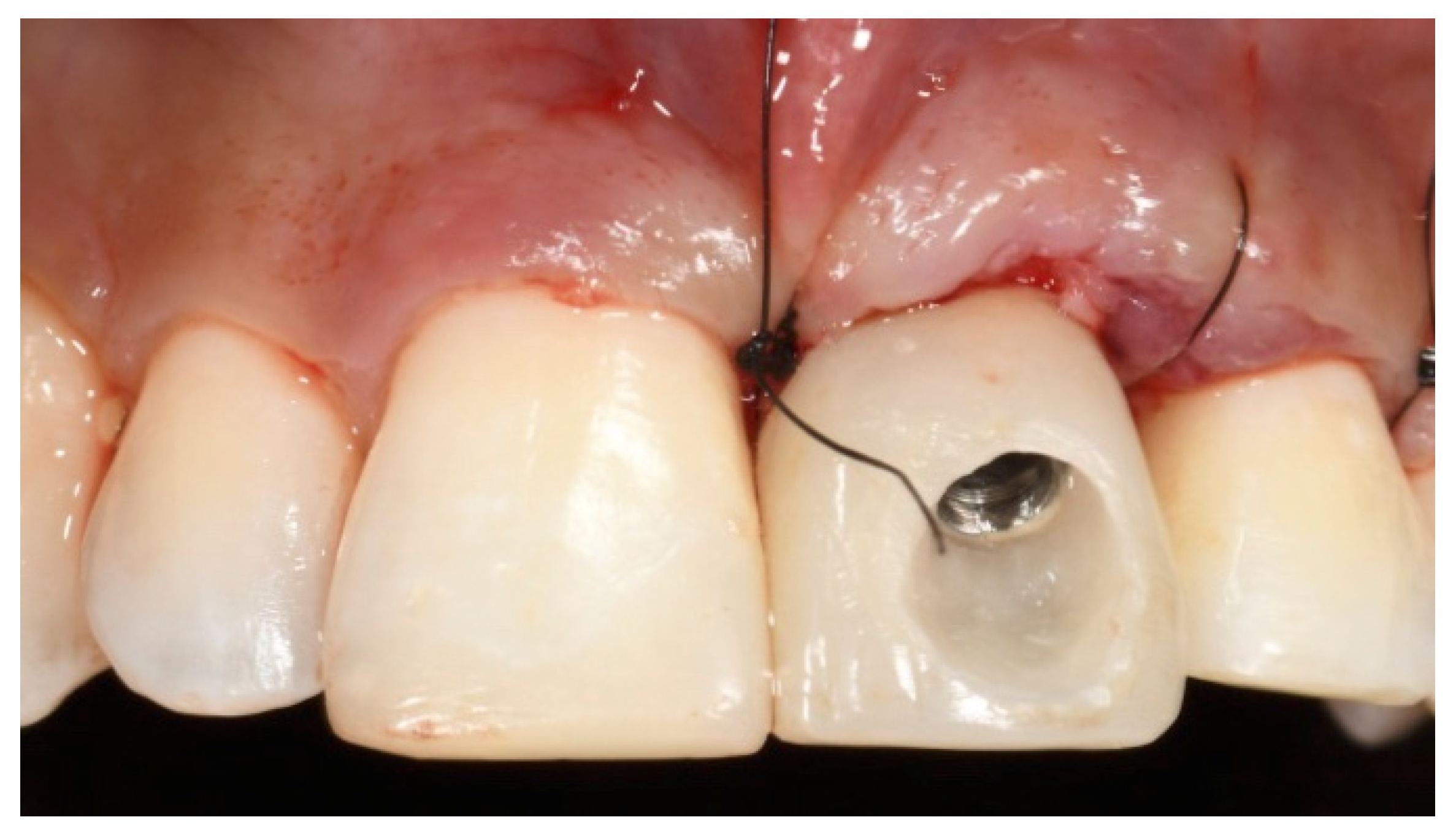 Prosthesis 03 00021 g015 550