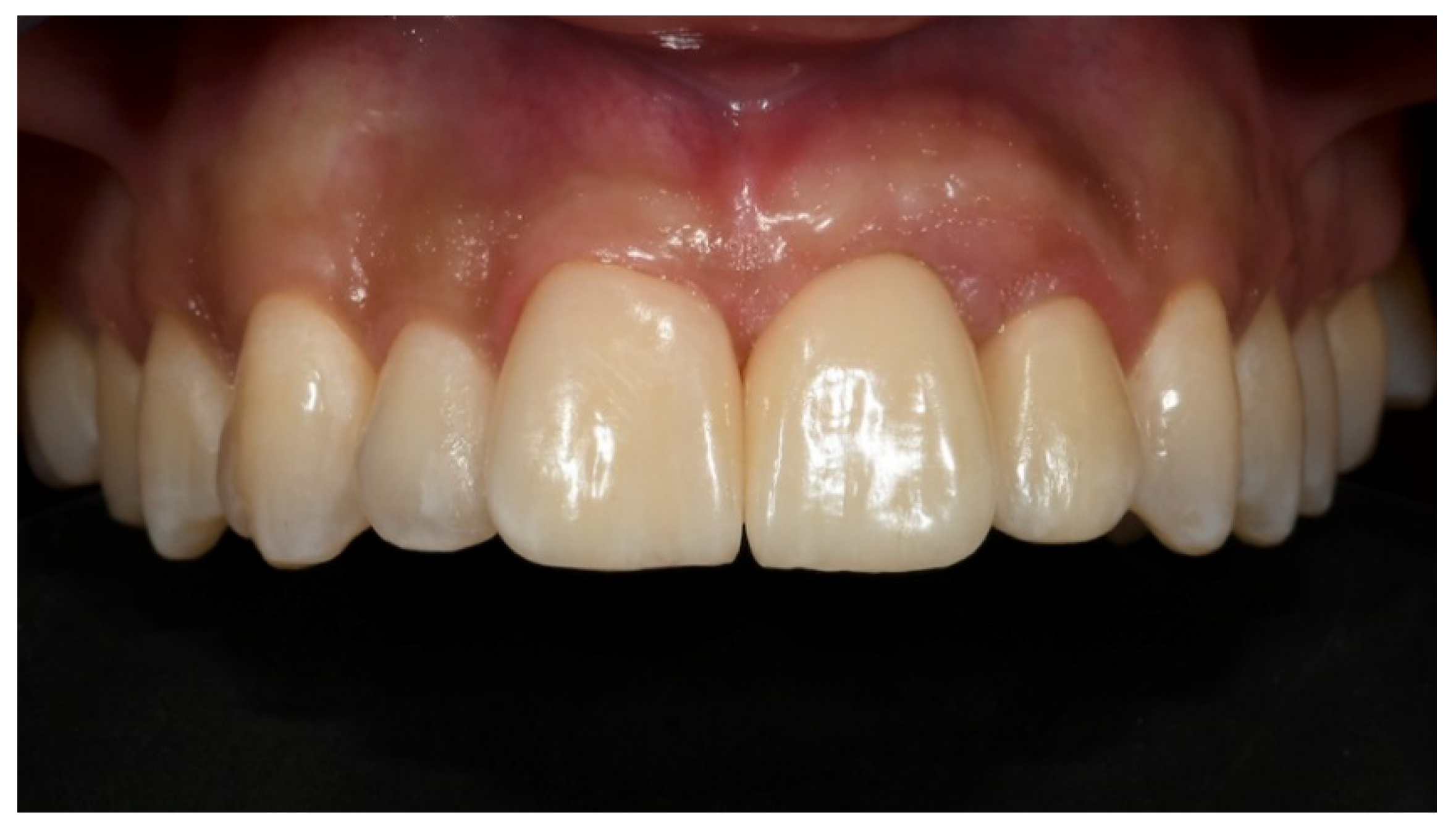 Prosthesis 03 00021 g016 550