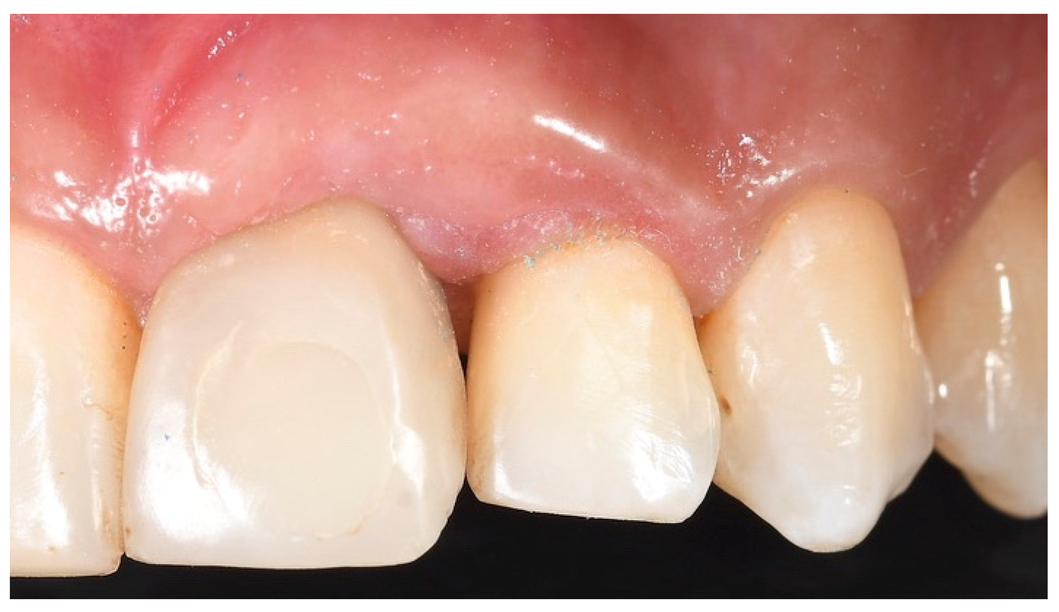 Prosthesis 03 00021 g017 550