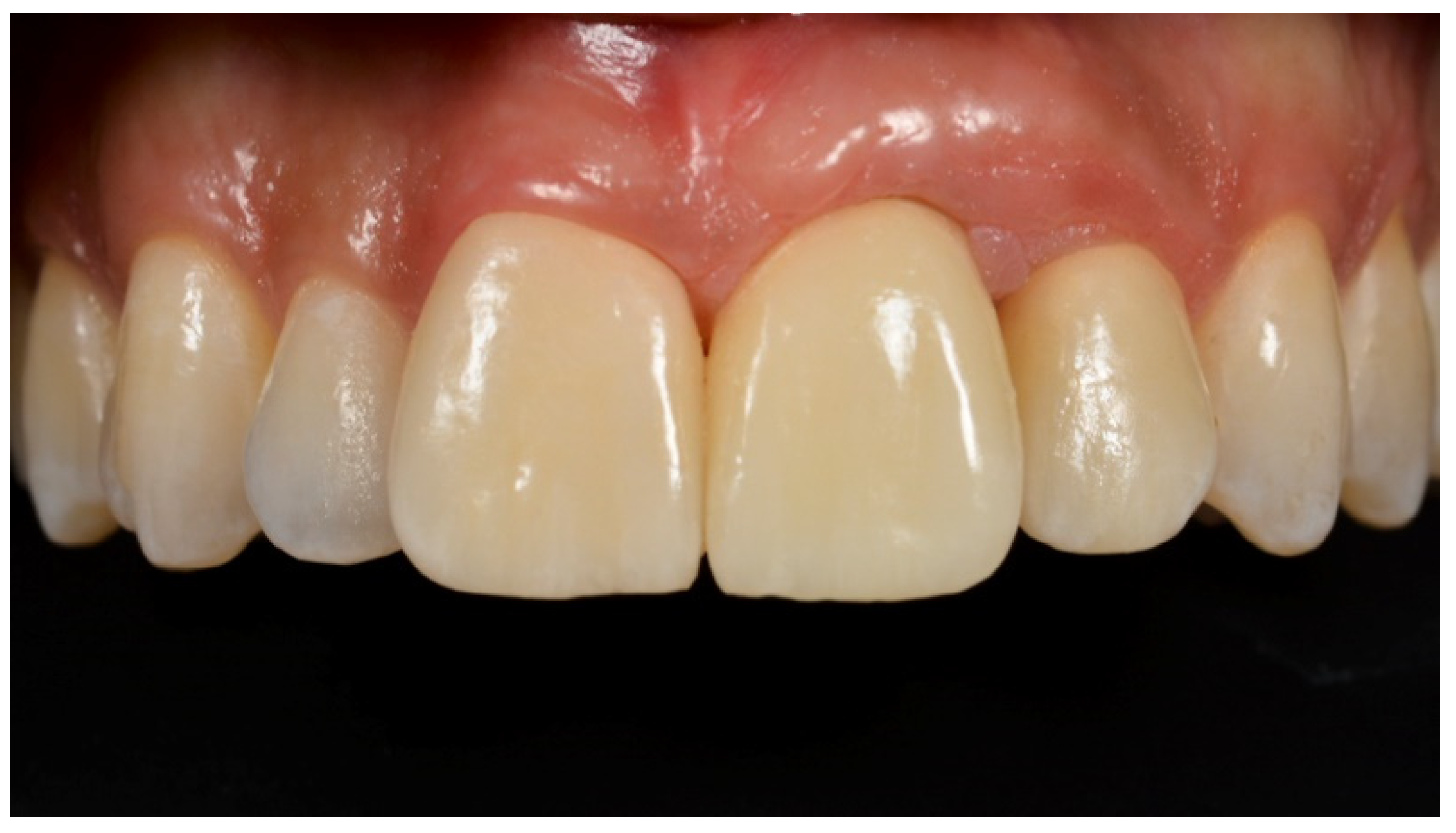 Prosthesis 03 00021 g018 550