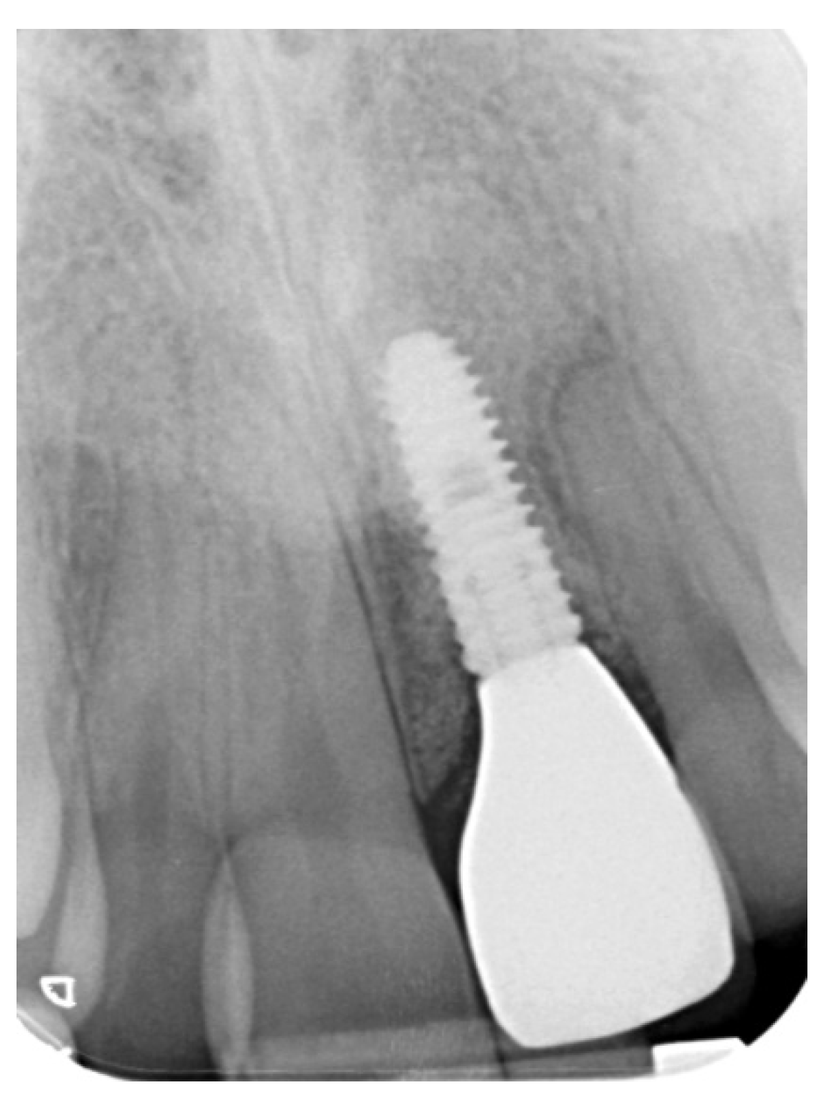 Prosthesis 03 00021 g019 550