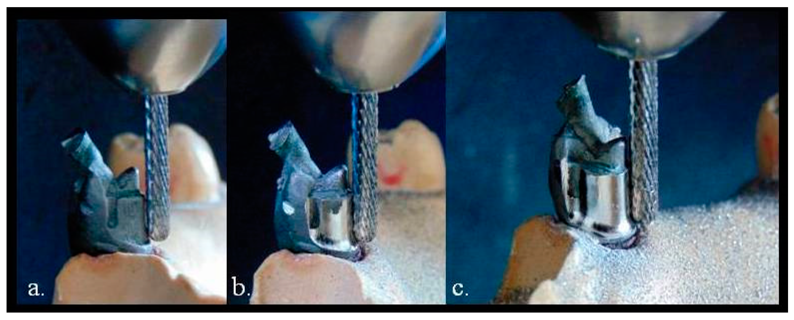 Prosthesis 03 00024 g002