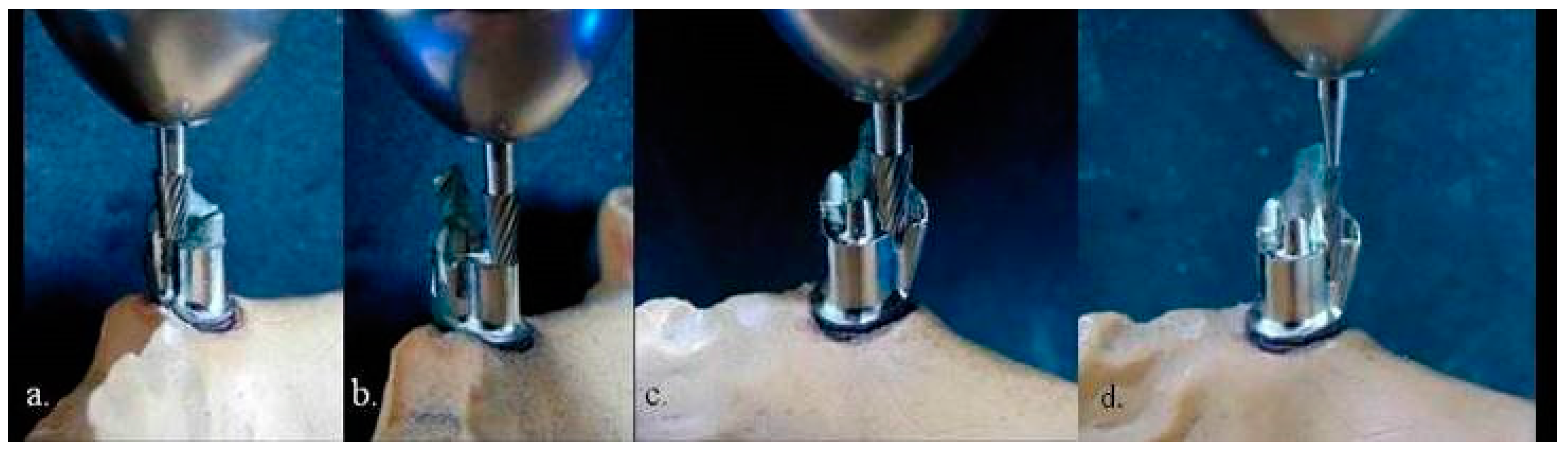 Prosthesis 03 00024 g003