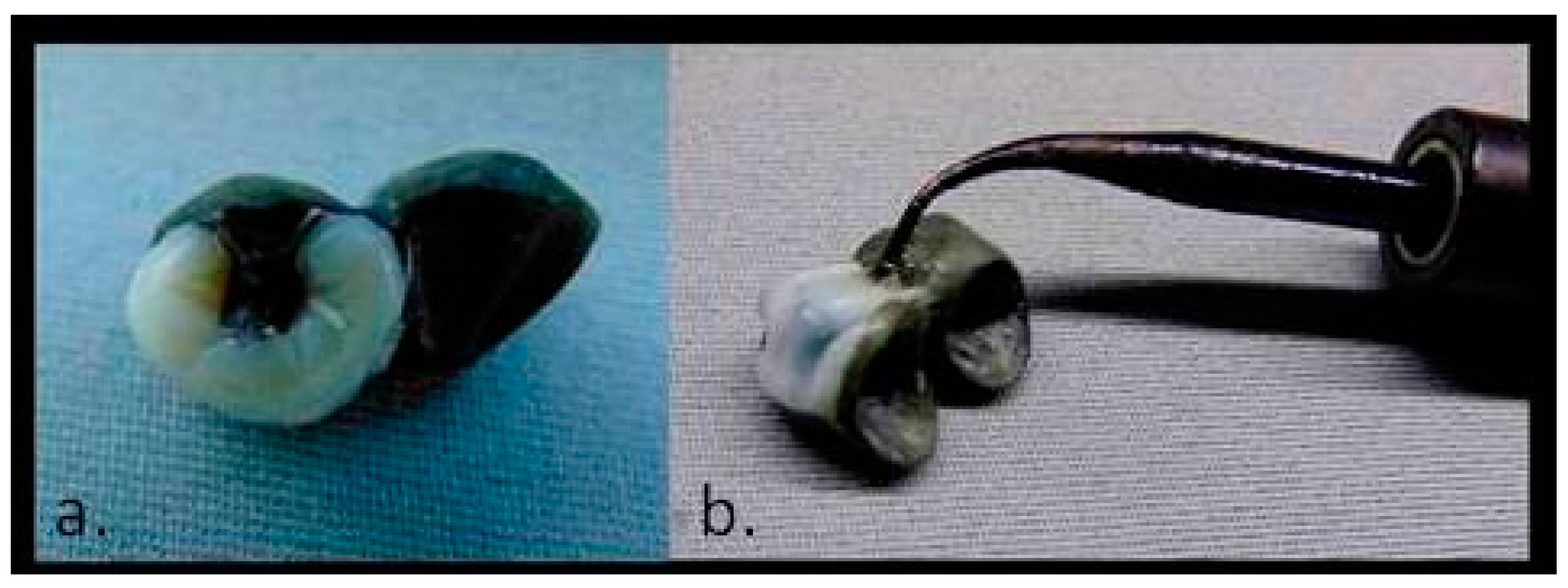 Prosthesis 03 00024 g009